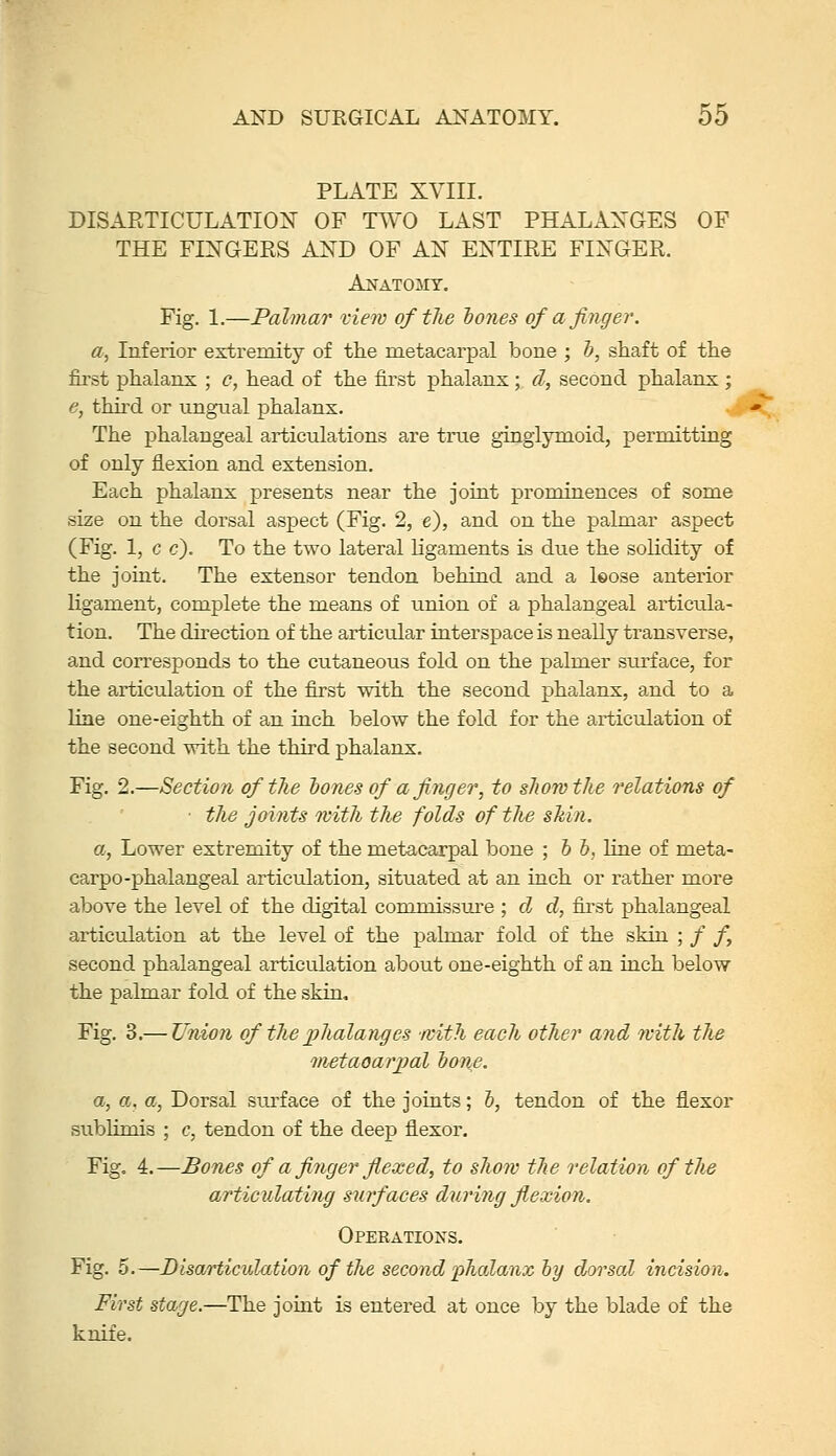 PLATE XYIII. DISARTICULATIOX OF T^VO LAST PHALANGES OF THE FINGERS AND OF AN ENTIRE FINGER. Anatomy. Fig. 1.—Palmar vieiv of the hones of a finger. «, Inferior extremity of the metacarpal bone ; T), shaft of the first phalanx ; c, head of the first phalanx; d, second phalanx ; e, third or ungual phalanx. The phalangeal articulations are true gingiymoid, permitting of only flexion and extension. Each phalanx presents near the joint prominences of some size on the dorsal aspect (Fig. 2, e), and on the palmar aspect (Fig. 1, c c). To the two lateral ligaments is due the solidity of the joint. The extensor tendon behind and a leose anterior ligament, complete the means of union of a phalangeal articula- tion. The direction of the articular interspace is neally transverse, and corresponds to the cutaneous fold on the palmer siu-face, for the articulation of the first with the second phalanx, and to a line one-eighth of an inch below the fold for the articulation of the second with the third phalanx. Fig. 2.—Section of the hones of a finger, to show the relations of ■ the joints with the folds of the shin, a, Lower extremity of the metacarpal bone ; h b, line of meta- carpo-phalangeal articulation, situated at an inch or rather more above the level of the digital commissure ; d d, first phalangeal articulation at the level of the palmar fold of the skin ; / /, second phalangeal articulation about one-eighth of an inch below the palmar fold of the skin. Fig. 3.— Union of theplialanges /cith each other and with the iiutaoarjjal hone. a, a, a, Dorsal surface of the joints; 5, tendon of the flexor sublimis ; c, tendon of the deep flexor. Fig. 4.—Bones of a finger fiexed, to show the relation of the articulating siirfaces during flexion. Operations. Fig. 5.—Disarticulation of the second phalanx ly dorsal incision. First stage.—The joint is entered at once by the blade of the knife.