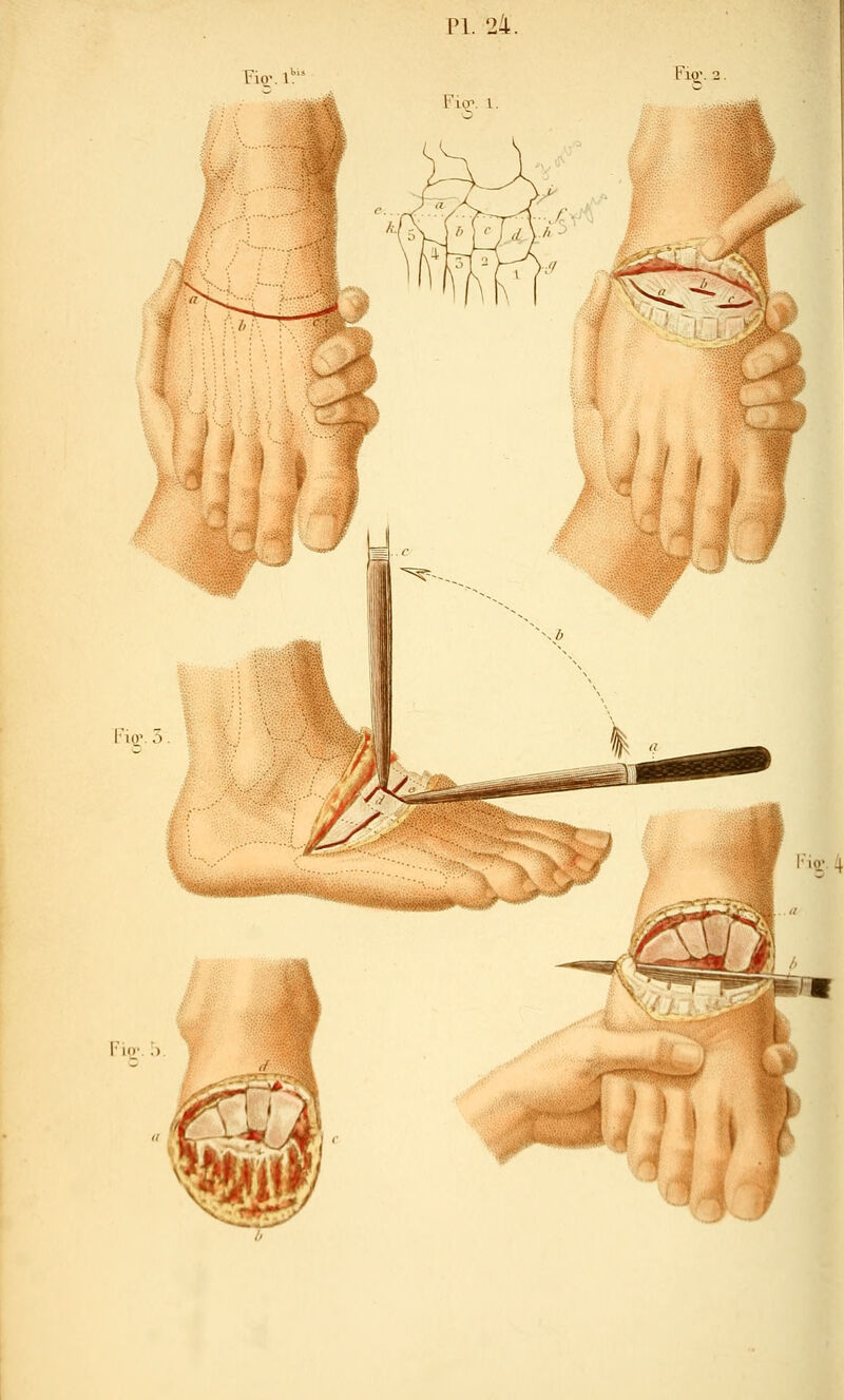 Fio- l* PI. 24. Fiq^. I. I-UV.5 Fio\ 2. Fkv. ;>