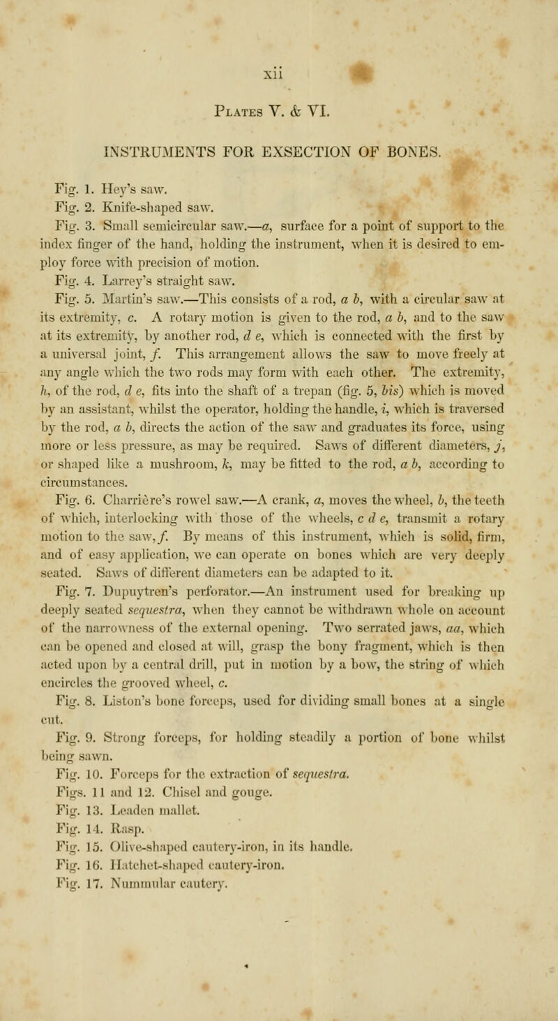 Plates V. & VI. INSTRUMENTS FOR EXSECTION OF BONES. Fig. l. Hey's saw. Fig. 2. Knife-shaped saw. Fig. 3. Small semicircular saw.—a, surface for a point of support to the index ringer of the hand, holding the instrument, when it is desired to em- ploy force with precision of motion. Fig. 4. Larrey's straight saw. Fig. 5. Martin's saw.—This consists of a rod, a b, with a circular saw at its extremity, c. A rotary motion is given to the rod, a b, and to the saw at its extremity, by another rod, d e, which is connected with the first by a universal joint, /. This arrangement allows the saw to move freely at any angle which the two rods may form with each other. The extremity, //, of the rod, d e, fits into the shaft of a trepan (fig. 5, bis) which is moved by an assistant, whilst the operator, holding the handle, i, which is traversed by the rod, a b, directs the action of the saw and graduates its force, using more or less pressure, as may be required. Saws of different diameters, j. or shaped like a mushroom, k, may be fitted to the rod, a b, according to circumstances. Fig. G. Charriere's rowel saw.—A crank, a, moves the wheel, b, the teeth of which, interlocking with those of the wheels, c d e, transmit a rotary motion t>> th • saw,/. By means of this instrument, which is solid, firm. and of easy application, we can operate on bones which are very deeply seated. Saws of different diameters can he adapted to it. Fig. 7. Dupuytren's perforator.—An instrument used for breaking up deeply seated sequestra, when they cannot be withdrawn whole on account of the narrowness of the external opening. Two serrated jaws, </</. which can lie opened and closed at will, grasp the bony fragment, which is then acted upon by a central drill, put in motion by a bow, the string of which encircles the grooved wheel, c. Fig. 8. Liston's hone forceps, used for dividing small bones at a single cut. Fig. 9. Strong forceps, for holding steadily a portion of hone whilst being sawn. Pig. in. Forceps for the extraction of sequestra. FigS. II and \J.. Chisel and gOUge. Fin-. 13, Leaden mall.'!. Pig. I l. Rasp. Pig. i.j. Olive-shaped cautery-iron, in its handle. Pig. Mi. II itchet-shaped cautery-iron.