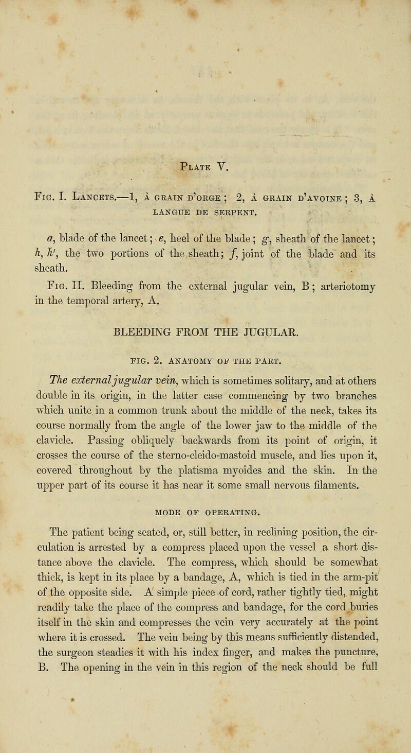 Fig. I. Lancets.—1, a grain d'orge ; 2, i. grain d'avoine ; 3, i. LANGUE DE SERPENT. a, blade of the lancet;. e, heel of the blade; g, sheath of the lancet; A, %', the two portions of the sheath; /, joint of the blade and its sheath. Fig. II. Bleeding from the external jugular vein, B; arteriotomy in the temporal artery, A. BLEEDING FROM THE JUGULAR. EIG. 2. ANATOMY OF THE PART. The external jugular vein, which is sometimes solitary, and at others double in its origin, in the latter case commencing by two branches which unite in a common trunk about the middle of the neck, takes its course normally from the angle of the lower jaw to the middle of the clavicle. Passing obliquely backwards from its point of origin, it crosses the course of the sterno-cleido-mastoid muscle, and lies upon it, covered throughout by the platisma myoides and the skin. In the upper part of its course it has near it some small nervous filaments. MODE OF OPERATING. The patient being seated, or, still better, in reclining position, the cir- culation is arrested by a compress placed upon the vessel a short dis- tance above the clavicle. The compress, which should be somewhat thick, is kept in its place by a bandage, A, which is tied in the arm-pit of the opposite side. A simple piece of cord, rather tightly tied, might readily take the place of the compress and bandage, for the cord buries itself in the skin and compresses the vein very accurately at the point where it is crossed. The vein being by this means sufficiently distended, the surgeon steadies it with his index finger, and makes the puncture, B. The opening in the vein in this region of the neck should be full