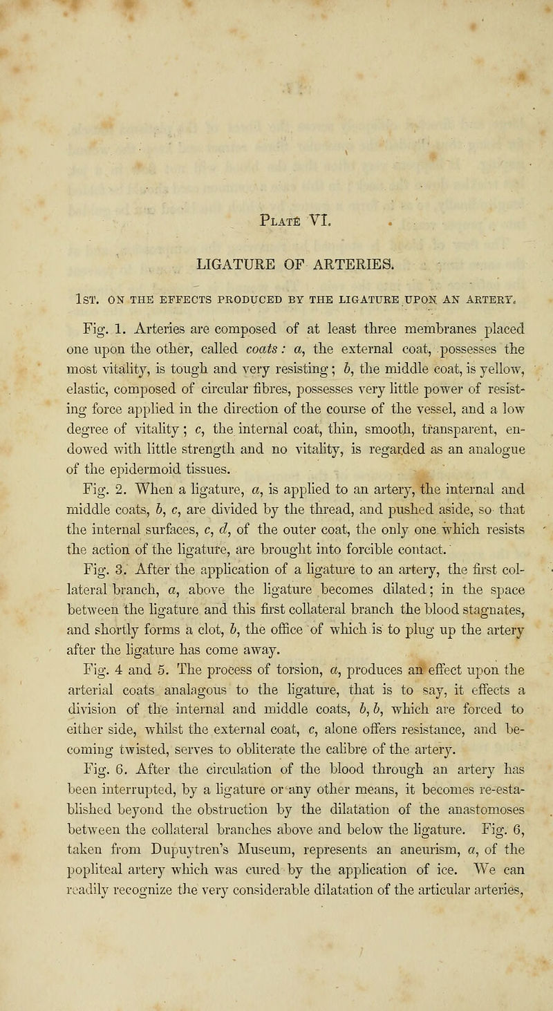 LIGATURE OF ARTERIES. 1st. on the effects produced by the ligature upon an artery. Fig. 1. Arteries are composed of at least three membranes placed one upon the other, called coats: a, the external coat, possesses the most vitality, is tough and very resisting; b, the middle coat, is yellow, elastic, composed of circular fibres, possesses very little power of resist- ing force applied in the direction of the course of the vessel, and a low degree of vitality; c, the internal coat, thin, smooth, transparent, en- dowed with little strength and no vitality, is regarded as an analogue of the epidermoid tissues. Fig. 2. When a ligature, a, is applied to an artery, the internal and middle coats, b, c, are divided by the thread, and pushed aside, so that the internal surfaces, c, d, of the outer coat, the only one which resists the action of the ligature, are brought into forcible contact.' Fig. 3. After the application of a ligature to an artery, the first col- lateral branch, a, above the ligature becomes dilated; in the space between the ligature and this first collateral branch the blood stagnates, and shortly forms a clot, b, the office of which is to plug up the artery after the ligature has come away. Fig. 4 and 5. The process of torsion, a, produces an effect upon the arterial coats analagous to the ligature, that is to say, it effects a division of the internal and middle coats, b, b, which are forced to either side, whilst the external coat, c, alone offers resistance, and be- coming twisted, serves to obliterate the calibre of the artery. Fig. 6. After the circulation of the blood through an artery has been interrupted, by a ligature or any other means, it becomes re-esta- blished beyond the obstruction by the dilatation of the anastomoses between the collateral branches above and below the ligature. Fig. 6, taken from Dupuytren's Museum, represents an aneurism, a, of the popliteal artery which was cured by the application of ice. We can readily recognize the very considerable dilatation of the articular arteries,