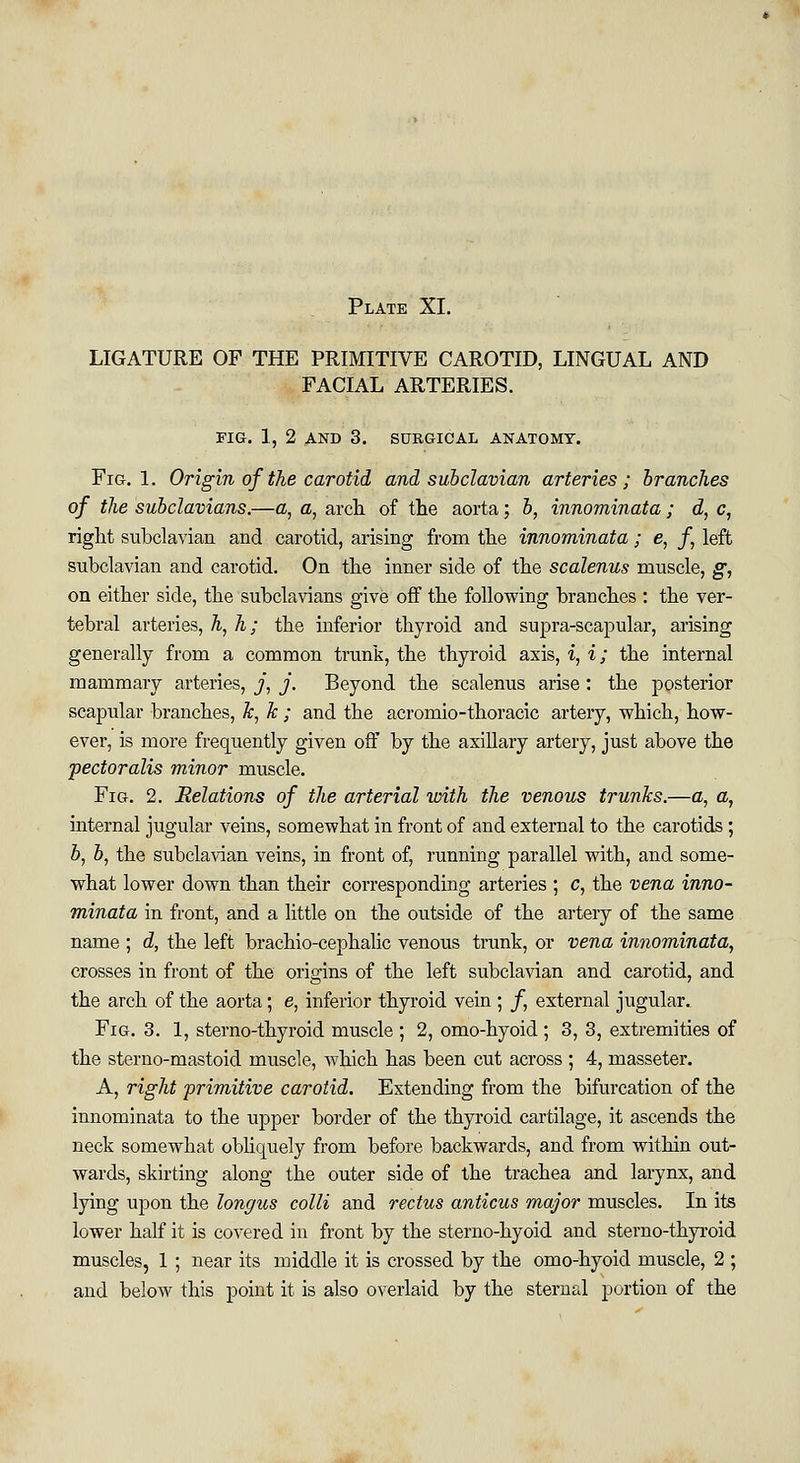 LIGATURE OF THE PRIMITIVE CAROTID, LINGUAL AND FACIAL ARTERIES. FIG. 1, 2 AND 3. SURGICAL ANATOMY. Fig. 1. Origin of the carotid and subclavian arteries; brandies of the subclavians.—a, a, arch of the aorta; b, innominata ; d, c, right subclavian and carotid, arising from the innominata; e, f left subclavian and carotid. On the inner side of the scalenus muscle, g, on either side, the subclavians give off the following branches : the ver- tebral arteries, h, h; the inferior thyroid and supra-scapular, arising generally from a common trunk, the thyroid axis, i, i; the internal mammary arteries, j, j. Beyond the scalenus arise: the posterior scapular branches, k, k ; and the acromio-thoracic artery, which, how- ever, is more frequently given off by the axillary artery, just above the pectoralis minor muscle. Fig. 2. Relations of the arterial with the venous trunks.—a, a, internal jugular veins, somewhat in front of and external to the carotids; b, &, the subclavian veins, in front of, running parallel with, and some- what lower down than their corresponding arteries ; c, the vena inno- minata in front, and a little on the outside of the artery of the same name ; d, the left brachio-cephalic venous trunk, or vena innominata, crosses in front of the origins of the left subclavian and carotid, and the arch of the aorta; e, inferior thyroid vein ; /, external jugular. Fig. 3. 1, sterno-thyroid muscle ; 2, omo-hyoid ; 3, 3, extremities of the sterno-mastoid muscle, which has been cut across ; 4, masseter. A, right primitive carotid. Extending from the bifurcation of the innominata to the upper border of the thyroid cartilage, it ascends the neck somewhat obliquely from before backwards, and from within out- wards, skirting along the outer side of the trachea and larynx, and lying upon the longus colli and rectus anticus major muscles. In its lower half it is covered in front by the sterno-hyoid and sterno-thyroid muscles, 1 ; near its middle it is crossed by the omo-hyoid muscle, 2 ; and below this point it is also overlaid by the sternal portion of the