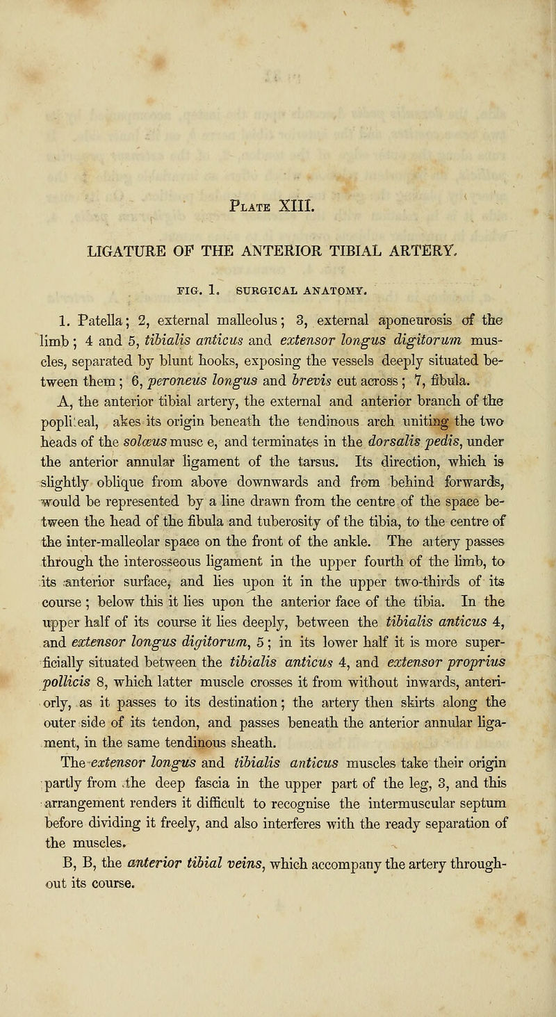 LIGATURE OP THE ANTERIOR TIBIAL ARTERY. FIG. 1. SURGICAL ANATOMY. 1. Patella; 2, external malleolus; 3, external aponeurosis of trie limb ; 4 and 5, tibialis anticus and extensor longus digitorum mus- cles, separated by blunt books, exposing tbe vessels deeply situated be- tween them; 6, peroneus longus and brevis cut across ; 7, fibula. A, tbe anterior tibial artery, tbe external and anterior branch of the popli'eal, akes its origin beneath the tendinous arch uniting the two heads of the solceus muse e, and terminates in the dorsalis pedis, under the anterior annular ligament of the tarsus. Its direction, which is slightly oblique from above downwards and from behind forwards, would be represented by a line drawn from the centre of the space be- tween the head of the fibula and tuberosity of the tibia, to the centre of the inter-malleolar space on the front of the ankle. The aitery passes through the interosseous ligament in the upper fourth of the limb, to its ,-anterior surface, and lies ivpon it in the upper two-thirds of its course ; below this it lies upon the anterior face of the tibia. In the upper half of its course it lies deeply, between the tibialis anticus 4, and extensor longus digitorum, 5; in its lower half it is more super- ficially situated between the tibialis anticus 4, and extensor proprius pollicis 8, which latter muscle crosses it from without inwards, anteri- orly, as it passes to its destination; the artery then skirts along the outer side of its tendon, and passes beneath the anterior annular liga- ment, in the same tendinous sheath. The extensor longus and tibialis anticus muscles take their origin partly from >the deep fascia in the upper part of the leg, 3, and this arrangement renders it difficult to recognise the intermuscular septum before dividing it freely, and also interferes with the ready separation of the muscles. B, B, the anterior tibial veins, which accompany the artery through- out its course.