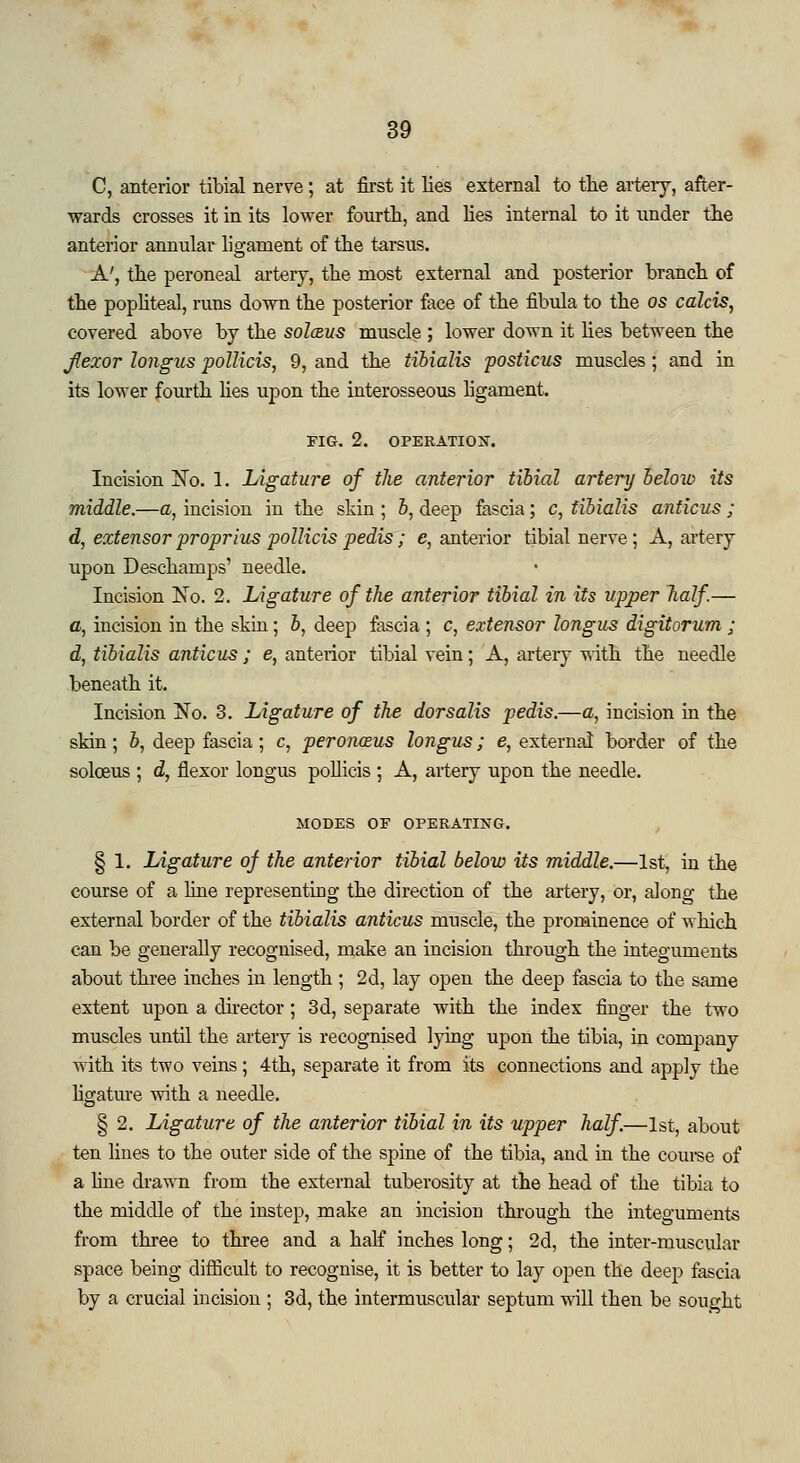 C, anterior tibial nerve; at first it lies external to the artery, after- wards crosses it in its lower fourth, and lies internal to it nnder the anterior annular ligament of the tarsus. A', the peroneal artery, the most external and posterior branch of the popliteal, runs down the posterior face of the fibula to the os calcis, covered above by the sol&us muscle ; lower down it lies between the Jlexor longus pollicis, 9, and the tibialis posticus muscles ; and in its lower fourth lies upon the interosseous ligament. FIG. 2. OPERATION. Incision ~No. 1. Ligature of the anterior tibial artery beloio its middle.—a, incision in the skin ; 6, deep fascia; c, tibialis anticus ; d, extensor proprius pollicis pedis; e, anterior tibial nerve; A, artery upon Deschamps' needle. Incision No. 2. Ligature of the anterior tibial in its upper half.— a, incision in the skin; b, deep fascia ; c, extensor longus digitorum ; d, tibialis anticus; e, anterior tibial vein; A, artery with the needle beneath it. Incision ~No. 3. Ligature of the dorsalis pedis.—a, incision in the skin; &, deep fascia; c, peronazus longus; e, external border of the solceus ; d, flexor longus pollicis ; A, artery upon the needle. MODES OF OPERATING. § 1. Ligature of the anterior tibial below its middle.—1st, in the course of a line representing the direction of the artery, or, along the external border of the tibialis anticus muscle, the prominence of which can be generally recognised, make an incision through the integuments about three inches in length ; 2d, lay open the deep fascia to the same extent upon a director; 3d, separate with the index finger the two muscles until the artery is recognised lying upon the tibia, in company with its two veins ; 4th, separate it from its connections and apply the ligature with a needle. § 2. Ligature of the anterior tibial in its upper half.—1st, about ten lines to the outer side of the spine of the tibia, and in the course of a line drawn from tbe external tuberosity at the head of the tibia to the middle of the instep, make an incision through the integuments from three to three and a half inches long; 2d, the inter-muscular space being difficult to recognise, it is better to lay open the deep fascia by a crucial incision ; 3d, the intermuscular septum will then be sought