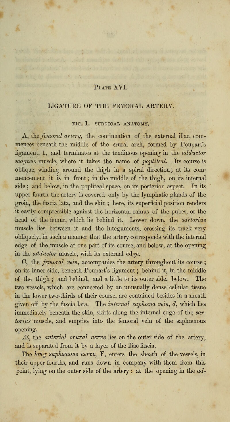 LIGATURE OF THE FEMORAL ARTERY. FIG. I. SURGICAL ANATOMY. A, the femoral artery, the continuation, of the external iliac, com- mences beneath the middle of the crural arch, formed by Poupart's ligament, 1, and terminates at the tendinous opening- in the adductor magnus muscle, where it takes the name of popliteal. Its course is oblique, winding- around the thigh in a spiral direction; at its com- mencement it is in front; in the middle of the thigh, on its internal side ; and below, in the popliteal space, on its posterior aspect. In its upper fourth the artery is covered only by the lymphatic glands of the groin, the fascia lata, and the skin ; here, its superficial position renders it easily compressible against the horizontal ramus of the pubes, or the head of the femur, which lie behind it. Lower down, the sartorius muscle lies between it and the integuments, crossing its track very obliquely, in such a manner that the artery corresponds with the internal edge of the muscle at one part of its course, and below, at the opening in the adductor muscle, with its external edge. C, the femoral vein, accompanies the artery throughout its course ; on its inner side, beneath Poupart's ligament; behind it, in the middle of the thigh ; and behind, and a little to its outer side, below. The two vessels, which are connected by an unusually dense cellular tissue in the lower two-thirds of their course, are contained besides in a sheath given off by the fascia lata. The internal saphoena vein, d, which lies immediately beneath the skin, skirts along the internal edge of the sar- torius muscle, and empties into the femoral vein of the saphoenous opening. M, the anterial crural nerve lies on the outer side of the artery, and is separated from it by a layer of the iliac fascia. The long saphoenous nerve, F, enters the sheath of the vessels, in their upper fourths, and runs down in company with them from this point, lying on the outer side of the artery ; at the opening in the ad-