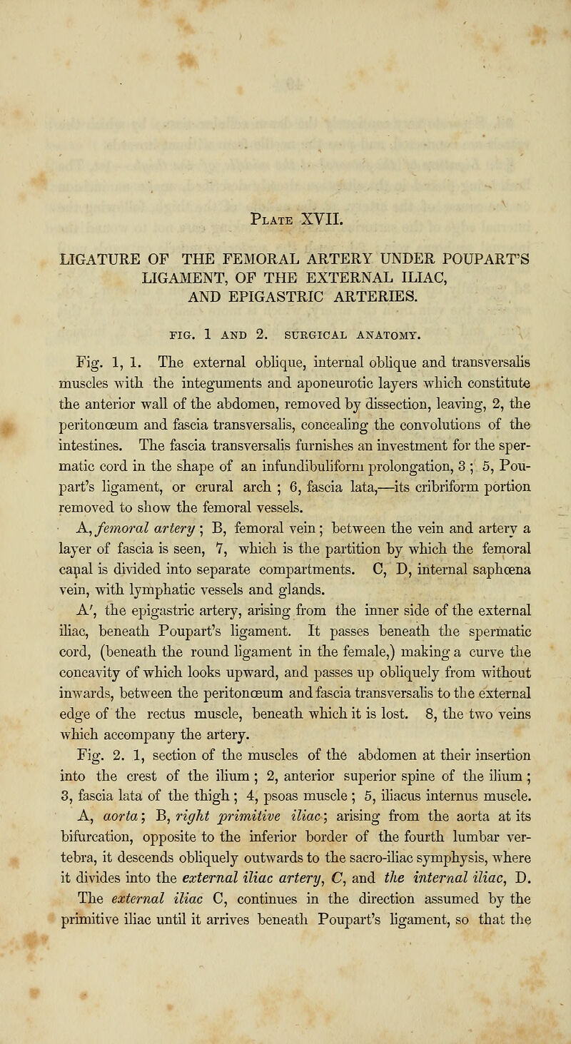 LIGATURE OF THE FEMORAL ARTERY UNDER POUPART'S LIGAMENT, OF THE EXTERNAL ILIAC, AND EPIGASTRIC ARTERIES. FIG. 1 AND 2. SURGICAL ANATOMY. Fig. 1,1. The external oblique, internal oblique and transversalis muscles with the integuments and aponeurotic layers which constitute the anterior wall of the abdomen, removed by dissection, leaving, 2, the peritonoeum and fascia transversalis, concealing the convolutions of the intestines. The fascia transversalis furnishes an investment for the sper- matic cord in the shape of an infundibuliform prolongation, 3 ; 5, Pou- part's ligament, or crural arch ; 6, fascia lata,—its cribriform portion removed to show the femoral vessels. A, femoral artery ; B, femoral vein; between the vein and artery a layer of fascia is seen, 7, which is the partition by which the femoral canal is divided into separate compartments. C, D, internal saphcena vein, with lymphatic vessels and glands. A', the epigastric artery, arising from the inner side of the external iliac, beneath Poupart's ligament. It passes beneath the spermatic cord, (beneath the round ligament in the female,) making a curve the concavity of which looks upward, and passes up obliquely from without inwards, between the peritonoeum and fascia transversalis to the external edge of the rectus muscle, beneath which it is lost. 8, the two veins which accompany the artery. Fig. 2. 1, section of the muscles of the abdomen at their insertion into the crest of the ilium; 2, anterior superior spine of the ilium; 3, fascia lata of the thigh ; 4, psoas muscle ; 5, iliacus internus muscle. A, aorta; B, right primitive iliac; arising from the aorta at its bifurcation, opposite to the inferior border of the fourth lumbar ver- tebra, it descends obliquely outwards to the sacro-iliac symphysis, where it divides into the external iliac artery, C, and the internal iliac, D. The external iliac C, continues in the direction assumed by the primitive iliac until it arrives beneath Poupart's ligament, so that the
