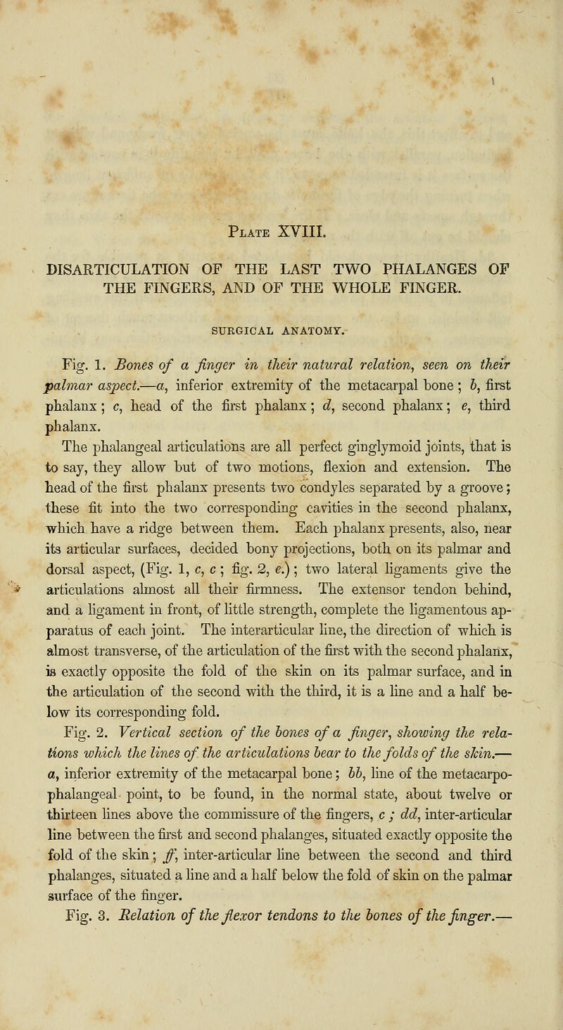 Plate XVIII. DISARTICULATION OF THE LAST TWO PHALANGES OF THE FINGERS, AND OF THE WHOLE FINGER. SURGICAL ANATOMY. Fig. 1. Bones of a finger in their natural relation, seen on their palmar aspect.—a, inferior extremity of the metacarpal bone ; b, first phalanx; c, head of the first phalanx; d, second phalanx; e, third phalanx. The phalangeal articulations are all perfect ginglymoid joints, that is to say, they allow hut of two motions, flexion and extension. The head of the first phalanx presents two condyles separated by a groove; these fit into the two corresponding cavities in the second phalanx, which have a ridge between them. Each phalanx presents, also, near its articular surfaces, decided bony projections, both on its palmar and dorsal aspect, (Fig. 1, c, c; fig. 2, e.); two lateral ligaments give the articulations almost all their firmness. The extensor tendon behind, and a ligament in front, of little strength, complete the ligamentous ap- paratus of each joint. The interarticular line, the direction of which is almost transverse, of the articulation of the first with the second phalanx, is exactly opposite the fold of the skin on its palmar surface, and in the articulation of the second with the third, it is a line and a half be- low its corresponding fold. Fig. 2. Vertical section of the bones of a finger, showing the rela- tions which the lines of the articulations bear to the folds of the skin.— a, inferior extremity of the metacarpal bone; bb, line of the metacarpo- phalangeal point, to be found, in the normal state, about twelve or thirteen lines above the commissure of the fingers, c ; dd, inter-articular line between the first and second phalanges, situated exactly opposite the fold of the skin; ff, inter-articular line between the second and third phalanges, situated a line and a half below the fold of skin on the palmar surface of the finger. Fig. 3. Relation of the flexor tendons to the bones of the finger.—