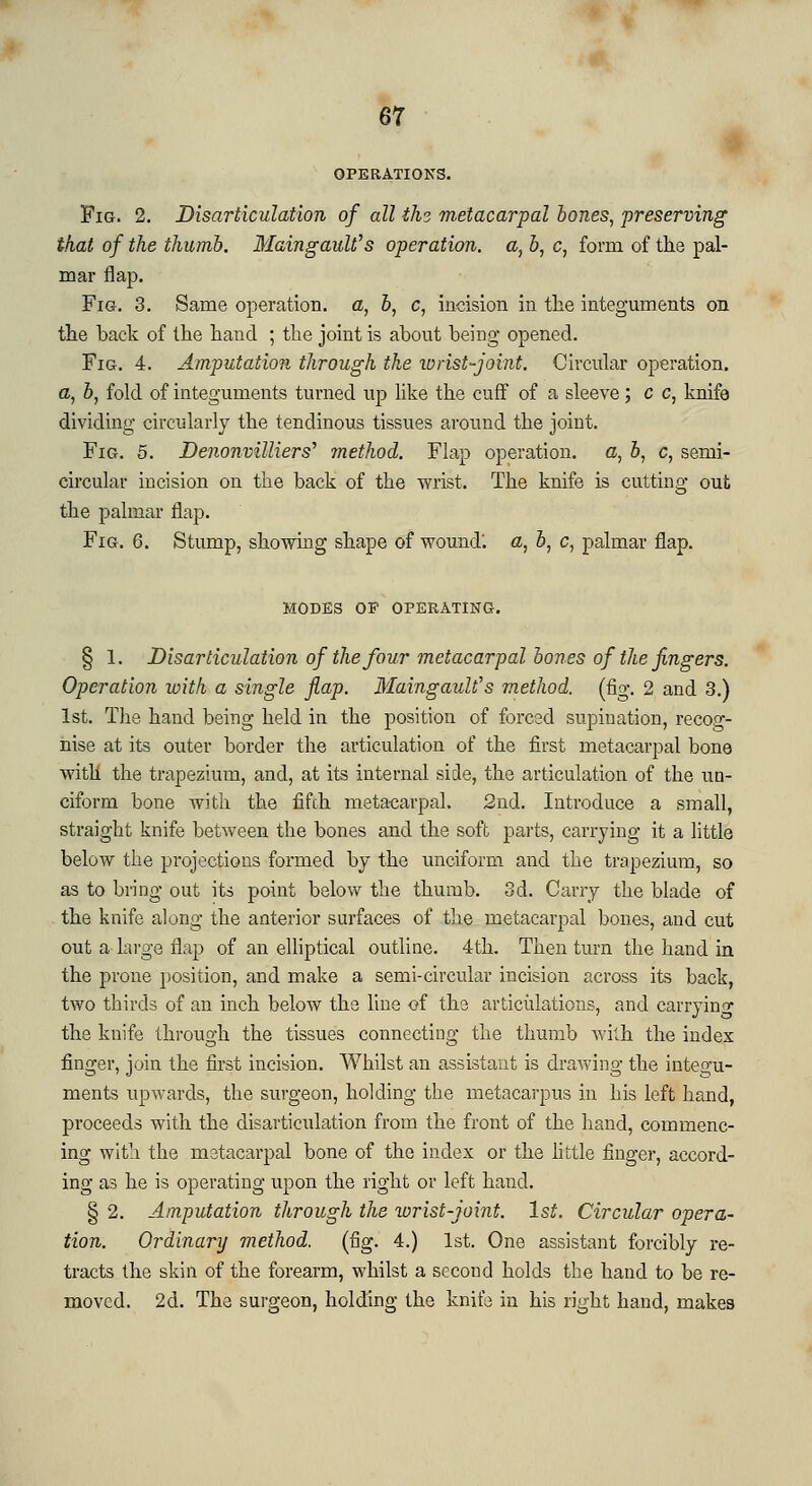 67 OPERATIONS. Fig. 2. Disarticulation of all thi metacarpal bones, preserving that of the thumb. Maingaulf s operation, a, b, c, form of the pal- mar flap. Fig. 3. Same operation, a, b, c, incision in the integuments on the back of the hand ; the joint is about being opened. Fig. 4. Amputation through the ivrist-joint. Circular operation. a, 6, fold of integuments turned up like the cuff of a sleeve; c c, knife dividing circularly the tendinous tissues around the joint. Fig. 5. Denonmlliers'' method. Flap operation, a, 5, c, semi- circular incision on the back of the wrist. The knife is cutting out the palmar flap. Fig. 6. Stump, showing shape of wound', a, 6, c, palmar flap. MODES OF OPERATING. § 1. Disarticulation of the four metacarpal bones of the fingers. Operation with a single flap. MaingauW s method, (fig. 2 and 3.) 1st. The hand being held in the position of forced supination, recog- nise at its outer border the articulation of the first metacarpal bone with the trapezium, and, at its internal side, the articulation of the un- ciform bone with the fifth metacarpal. 2nd. Introduce a small, straight knife between the bones and the soft parts, carrying it a little below the projections formed by the unciform and the trapezium, so as to bring out its point below the thumb. 3d. Cany the blade of the knife along the anterior surfaces of the metacarpal bones, and cut out a large flap of an elliptical outline. 4th. Then turn the hand in the prone position, and make a semi-circular incision across its back, two thirds of an inch below the line of the articulations, and carryino- the knife through the tissues connecting the thumb with the index finger, join the first incision. Whilst an assistant is drawing the integu- ments upwards, the surgeon, holding the metacarpus in his left hand, proceeds with the disarticulation from the front of the hand, commenc- ing with the metacarpal bone of the index or the little finger, accord- ing as he is operating upon the right or left hand. § 2. Amputation through the wrist-joint. 1st. Circular opera- tion. Ordinary method, (fig. 4.) 1st. One assistant forcibly re- tracts the skin of the forearm, whilst a second holds the hand to be re- moved. 2d. The surgeon, holding the knife in his right hand, makes