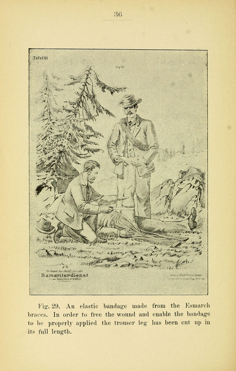 TafeiXI ■ ;4 V; - f% Samanter'difnst Fig-. 29. An elastic bandage made from the Esmarcli braces. In order to fi'ee the wonnd and enable the bandag-e to be properl}^ applied the tronser leg has been cut up in its Ml length.