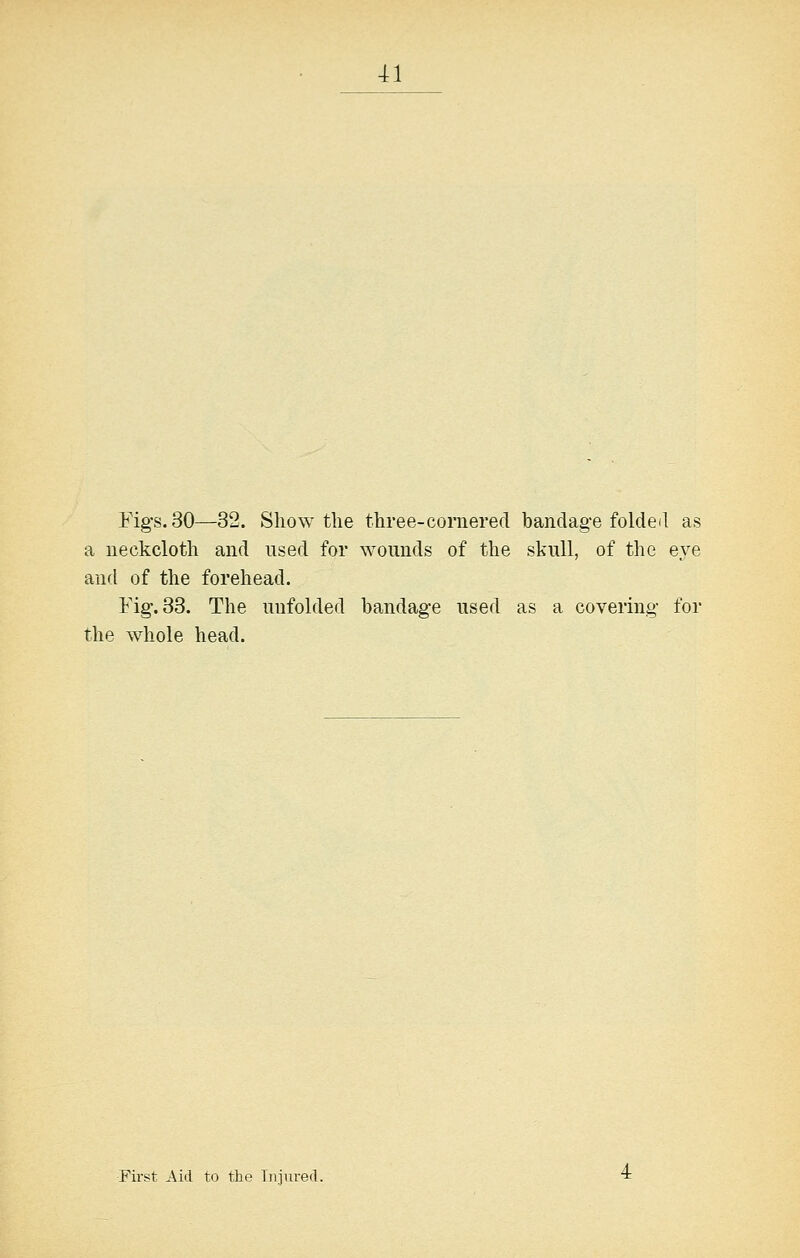 Fig-s. 30—32. Show the three-cornered bandag-e foldeil as a neckcloth and used for wounds of the skull, of the eye and of the forehead. Fig. 83. The unfolded bandage used as a covering for the whole head. First Aid to the Tiijured.