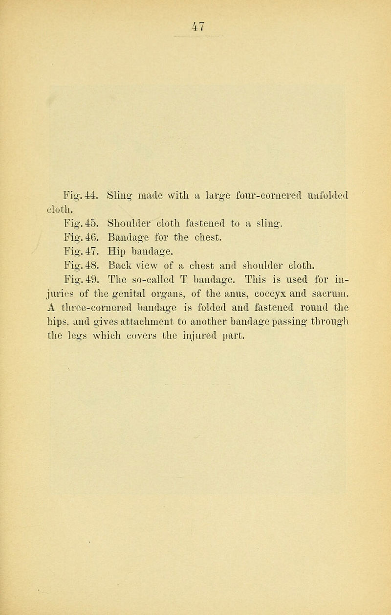 Fig-. 44. Sling' made with a large four-cornered unfolded cloth. Fig'. 45. Shoulder cloth fastened to a sling. Fig. 46. Bandage for the chest. Fig. 47. Hip handage. Fig. 48. Back view of a chest and shoulder cloth. Fig. 49. The so-called T bandage. This is used for in- juries of the genital organs, of the anus, coccyx and sacrum. A three-cornered bandage is folded and fastened round the hips, and gives attachment to another bandage i3 as sing througdi the legs which covers the injured part.