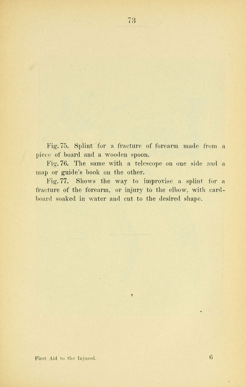 78 Fig. 75. Splint for a fracture of forearm made from a piece of board and a wooden spoon. Fig-. 76. The same with a telescope on one side and a map or guide's book on the other. Fig. 77. Shows the way to improvise a splint for a fracture of the forearm, or injmy to the elbow, with card- board soaked in water and cut to the desired shape. First Aid to the Injured.