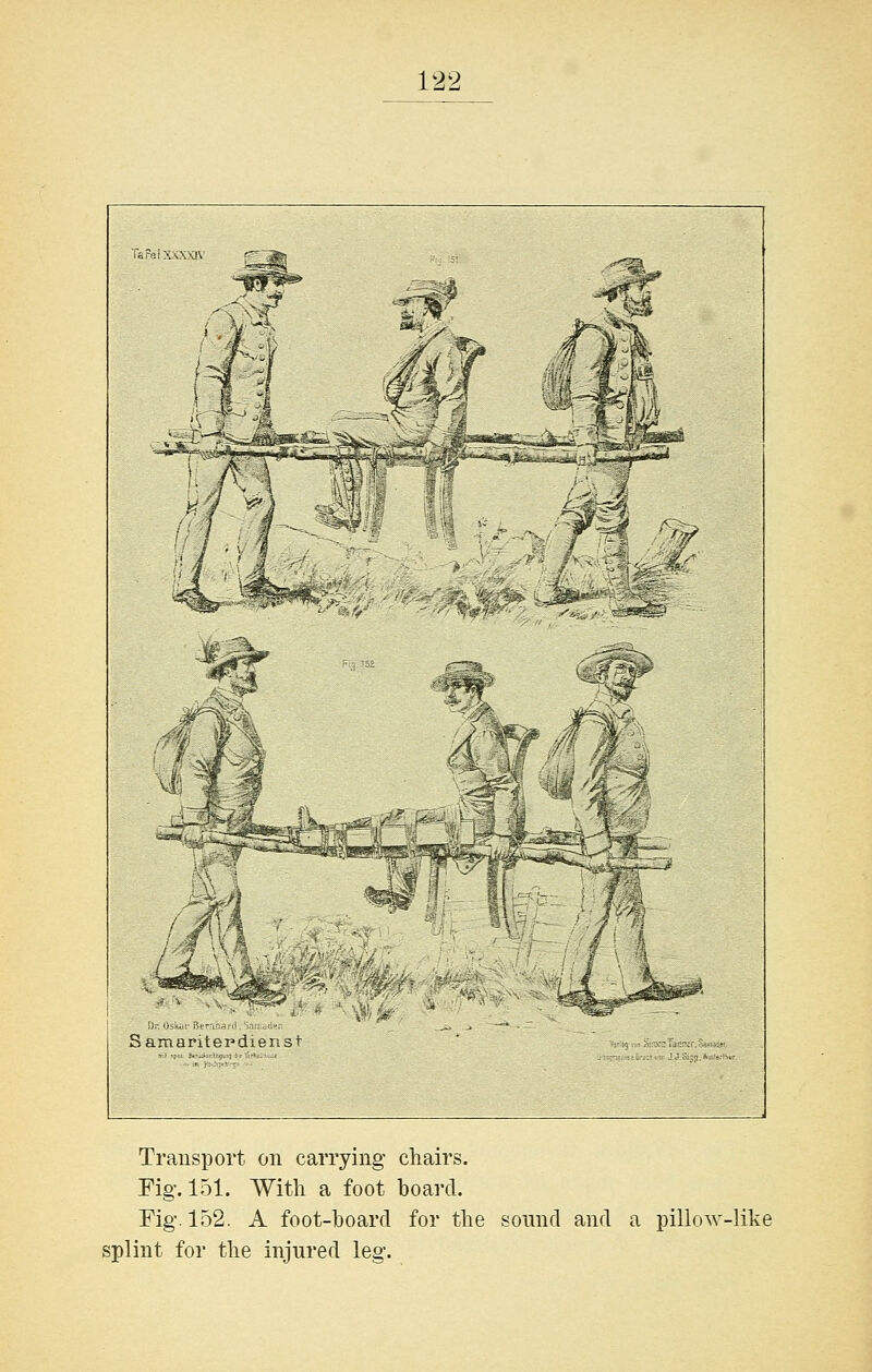 r„rpi\v\vl\. '-^ Samaraerd e'tc Transport on carrying chairs. Fig. 151. With a foot hoard. Fig. 152. A foot-hoard for the sound and a pillow-like splint for the injured leg.
