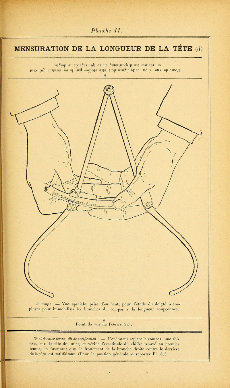 MENSURATION DE LA LONGUEUR DE LA TETE (rf) •oioiop oj op.icSoj inb 00 uo 'suonisodsip sd{ .io3i[Coj ua ina.v [iiL dnspjunsudui oj lud oatpnia oxy; iiop o.inSij a|)ûo nojj an.\. op lujoj 2e temps. — Vue spéciale, prise d'en haut, pour l'clude du doigté à em- ployer pour immobiliser les branches du compas à la longueur soupçonnée. Point de vue de Y observateur. ^>J 5 et dernier temps, dit de vérification. — L'opérat.^ur replace le compas, une fois fixé, sur la tète du sujet, et vérifie l'esactitude du chiffre trouvé au premier lemps, en s'assurant que le frottement de la branche droite contre le derrière delà tète est satisfaisant. (Pour la position générale se reporter PI. 8.)