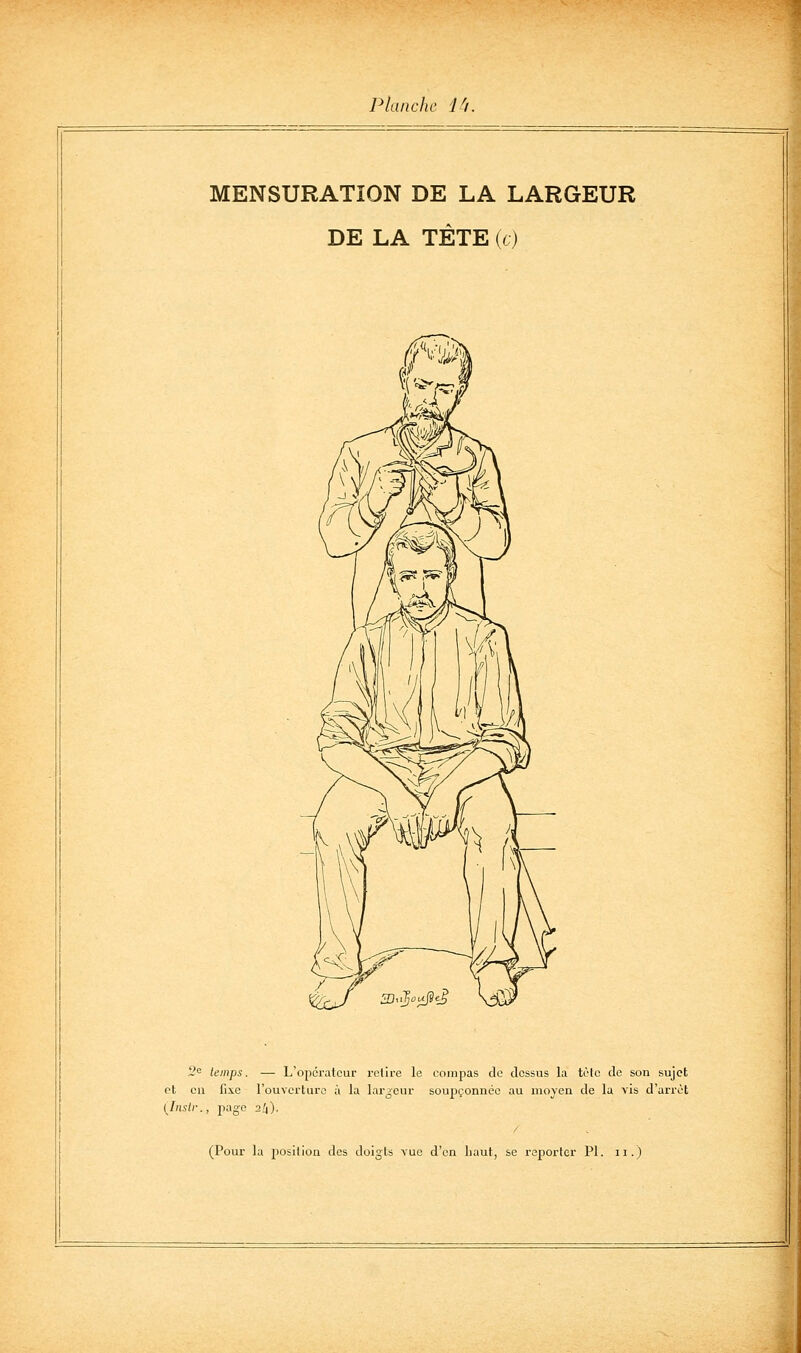 MENSURATION DE LA LARGEUR DE LA TÈTE (t) 2« temps. — L'operateur retire le compas de dessus la tète de son sujet et eu fixe l'ouverture à la largeur soupçonnée au moyen de la vis d'arrêt (Jnstr., page 2li). /