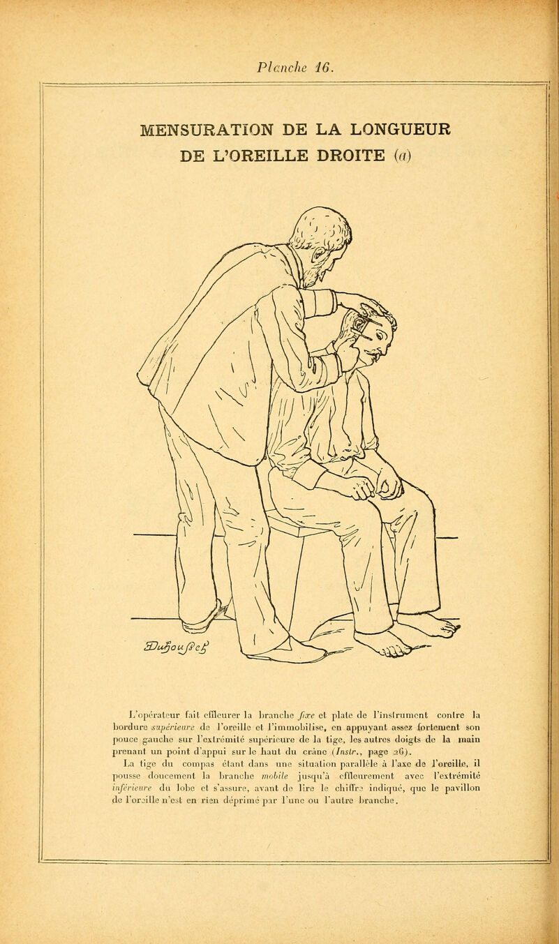 MENSURATION DE LA LONGUEUR DE L'OREILLE DROITE {a) SJu^ouf^e^ L'opérateur fait effleurer la brandie fixe el plaie de l'inslrumcnt contre la bordure sapérieare de l'oreille et l'iminohilise, en appuyant assez fortement son pouce g^iuche sur l'extrémité sujjérioure de la tige, les autres doigts do la main prenant un point d'appui sur le haut du crâne (fnslr., page sG). La tige du compas étant dans une situation parallèle à l'axe de l'oreille, il pousse doucement la branche mobile jusqu'à effleurement avec l'extrémité inférieure du lobe et s'assure, avant de lire le chilTrs indique, que le pavillon do l'oroille n'cL-t en rien déprime par l'une ou l'autre branche.