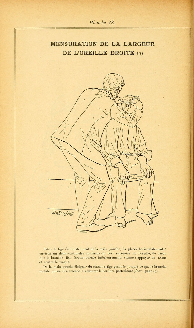 MENSURATION DE LA LARGEUR DE L'OREILLE DROITE [a) Saisir la tige de rinstrumenî do la main gauche, la placer horizontalement à environ un demi-centimètre au-dessus du bord supérieur do l'oreille, de façon que la branche fixe étroite tournée inférieurcmcnt, vienne s'appuyer en avant et contre le tragus. De la main gaucho éloigner du crâne la tige graduée jusqu'à ce que la branche mobile puisse être amenée à eflleurcr la bordure postérieure (/;isir., page 29).