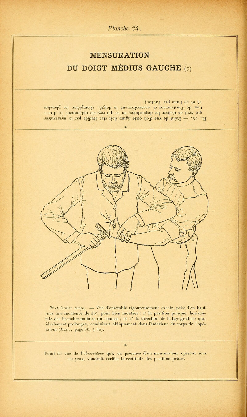 MENSURATION DU DOIGT MÉDIUS GAUCHE (c) s9i]ouc[d S8| J8iç)|dai0[)) ■9:)°iop oj ^uoiuajiossaooc is ^ugiunjjsutj ep uoi) -aajip Bf :juaiuim!}ou apjB.oaj inb 80 ua 'suonisodsip S8| jasu^aj ua ina.v inb .inj]r>.insu3m o\ acd aoipti^a ojjo jiop ajnSij aqqao no^p anA ap luioj — '^z u 3^ el dernier temps. — Vue d'ensemble rigoureusement exacte, prise d'en haut sous une incidence de /if), pour bien montrer : i la position presque horizon- tale des branches mobiles du compas ; et 2° la direction de la tige graduée qui, idéalement prolongée, conduirait obliquement dans l'intérieur du corps de l'opé- rateur (/;w//-., page 3G, § 3o). Point de vue de Vobservàteur qui, en présence d'un mcnsuraleur opérant sous ses yeux, voudrait vérifier la rectitude des positions prises.