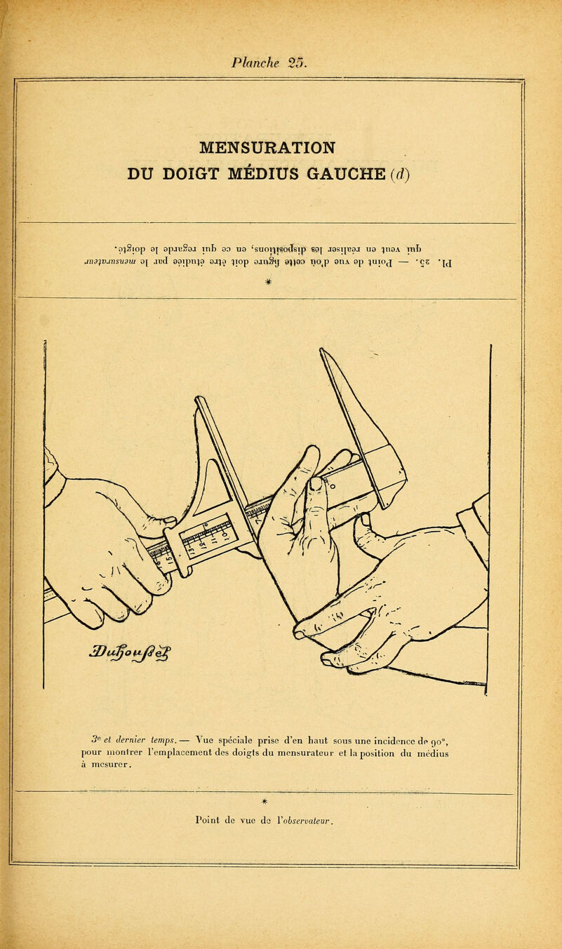 MENSURATION DU DOIGT MÉDIUS GAUCHE (d) un9fvjnsii9ut o\ .icd aaipnja si^a ijop ojnSij suao ijo^p qiia 9p lujoj — 'çc 'jj 3)t^;go^Q 3<'el dernier temps.— Vue spéciale prise d'en haut sous une incidence de Cjo, pour montrer l'emplacement des doigts du mensurateur et la position du médius à mesurer.