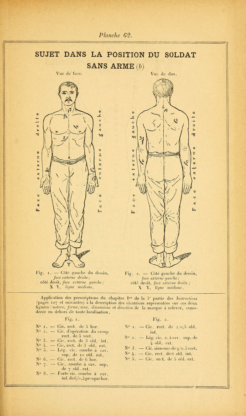 SUJET DANS LA POSITION DU SOLDAT SANS ARME (b) Vue de face. Vue de dos. I. — Côté eauclie face externe droite ; côté droit, face externe gauche , X Y, llijne médiane. Fig. 2. — Côté gaucho du dessin, face externe gauclte ; côté droit, face externe droile ; X Y, ligne médiane. Application des prescriptions du chapitre I^i- de la 3° partie des Instractions (pages 107 et suivantes) à la description des cicatrices représentées sur ces deux figures : nature, forme;sens, dimensions et direction de la marque à relever, consi- dérée en dehors de toute localisation. No I No 2 No 3 No li No a No 7 No 8. — Cic. rect. de ô hor. — Cic. d'opération du croup rect. de 3 vert. — Cic. roct. de 3 obi. int. — Cic. rect. de 3 ohl. ext. — Lég. cic. courbe à cav. sup. de 10 obi. ext. — Cic. courbe à cav. sup. de 7 obi. est. — Forte cic. courbe à cav. inf. de 6/0, i presque hor. Fig. 2. N° I. —Cic. rect. de 2/0,5 obi. int. Ko 2 . — i'ég- cic. c. àcav. sup. de 4 obi. ext. No 3 . — Cic. sinueuse de 9/0,5 vert. No ^ . — Cic. rect. de 0 obi. int.