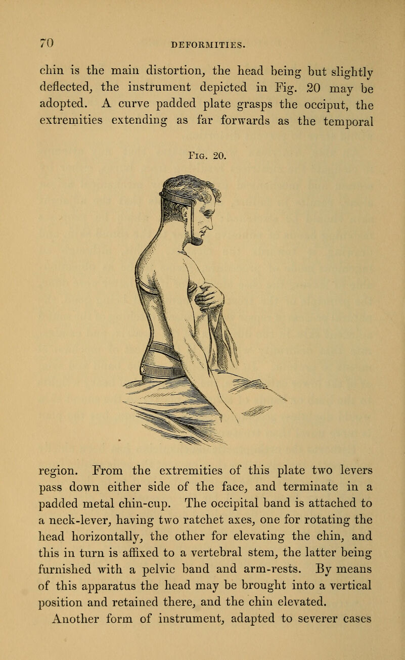 cliin is the main distortion^ the head being but slightly deflected,, the instrument depicted in Fig. 20 may be adopted. A curve padded plate grasps the occiput, the extremities extending as far forwards as the temporal Fig. 20. region. From the extremities of this plate two levers pass down either side of the face^ and terminate in a padded metal chin-cup. The occipital band is attached to a neck-lever^ having tAvo ratchet axes^ one for rotating the head horizontally, the other for elevating the chin, and this in turn is affixed to a vertebral stem, the latter being furnished with a pelvic band and arm-rests. By means of this apparatus the head may be brought into a vertical position and retained there, and the chin elevated. Another form of instrument, adapted to severer cases