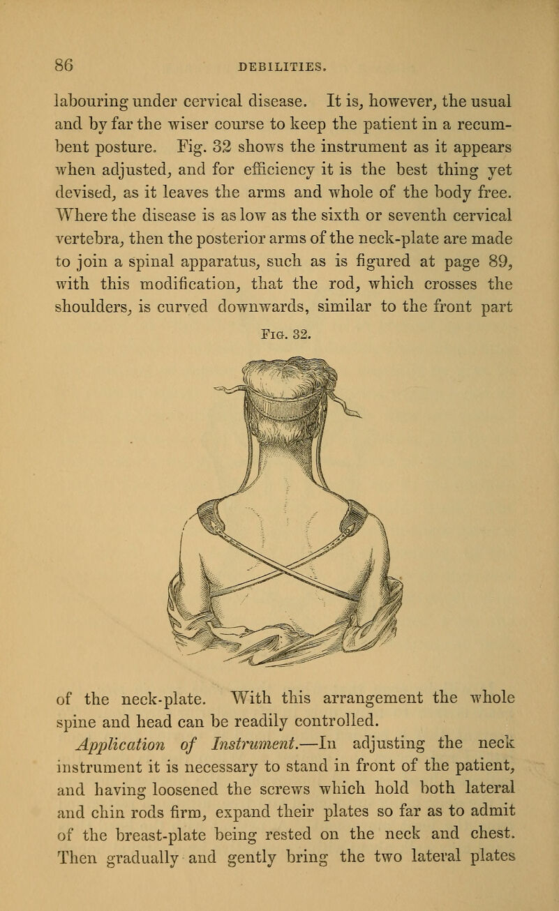 labouring under cervical disease. It is^ however^ the usual and by far the wiser course to keep the patient in a recum- bent posture. Fig. 32 shows the instrument as it appears when adjusted^ and for eiiiciency it is the best thing yet devised^ as it leaves the arms and whole of the body free. Where the disease is as low as the sixth or seventh cervical vertebra,, then the posterior arms of the neck-plate are made to join a spinal apparatus^ such as is figured at page 89, with this modification, that the rod, which crosses the shoulders, is curved downwards, similar to the front part Fi&. 32. of the neck-plate. With this arrangement the whole spine and head can be readily controlled. Application of Instrument.—In adjusting the neck instrument it is necessary to stand in front of the patient, and having loosened the screws which hold both lateral and chin rods firm, expand their plates so far as to admit of the breast-plate being rested on the neck and chest. Then gradually and gently bring the two lateral plates