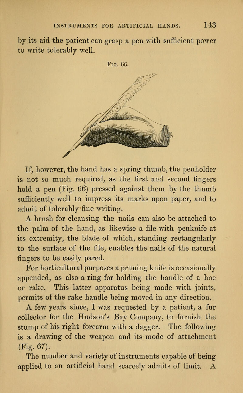 by its aid tlie patient can grasp a pen with sufficient power to write tolerably well. Fig. 66. If, however^ the hand has a spring thumb, the penholder is not so much required, as the first and second fingers hold a pen (Fig. 66) pressed against them by the thumb sufficiently well to impress its marks upon paper, and to admit of tolerably fine writing. A brush for cleansing the nails can also be attached to the palm of the hand, as likewise a file with penknife at its extremity, the blade of which, standing rectangularly to the surface of the file, enables the nails of the natural fingers to be easily pared. For horticultural purposes a pruning knife is occasionally appended, as also a ring for holding the handle of a hoe or rake. This latter apparatus being made with joints, permits of the rake handle being moved in any direction. A few years since, I was requested by a patient, a fur collector for the Hudson^s Bay Company, to furnish the stump of his right forearm with a dagger. The following is a drawing of the weapon and its mode of attachment (Fig. 67). The number and variety of instruments capable of being applied to an artificial hand scarcely admits of limit. A