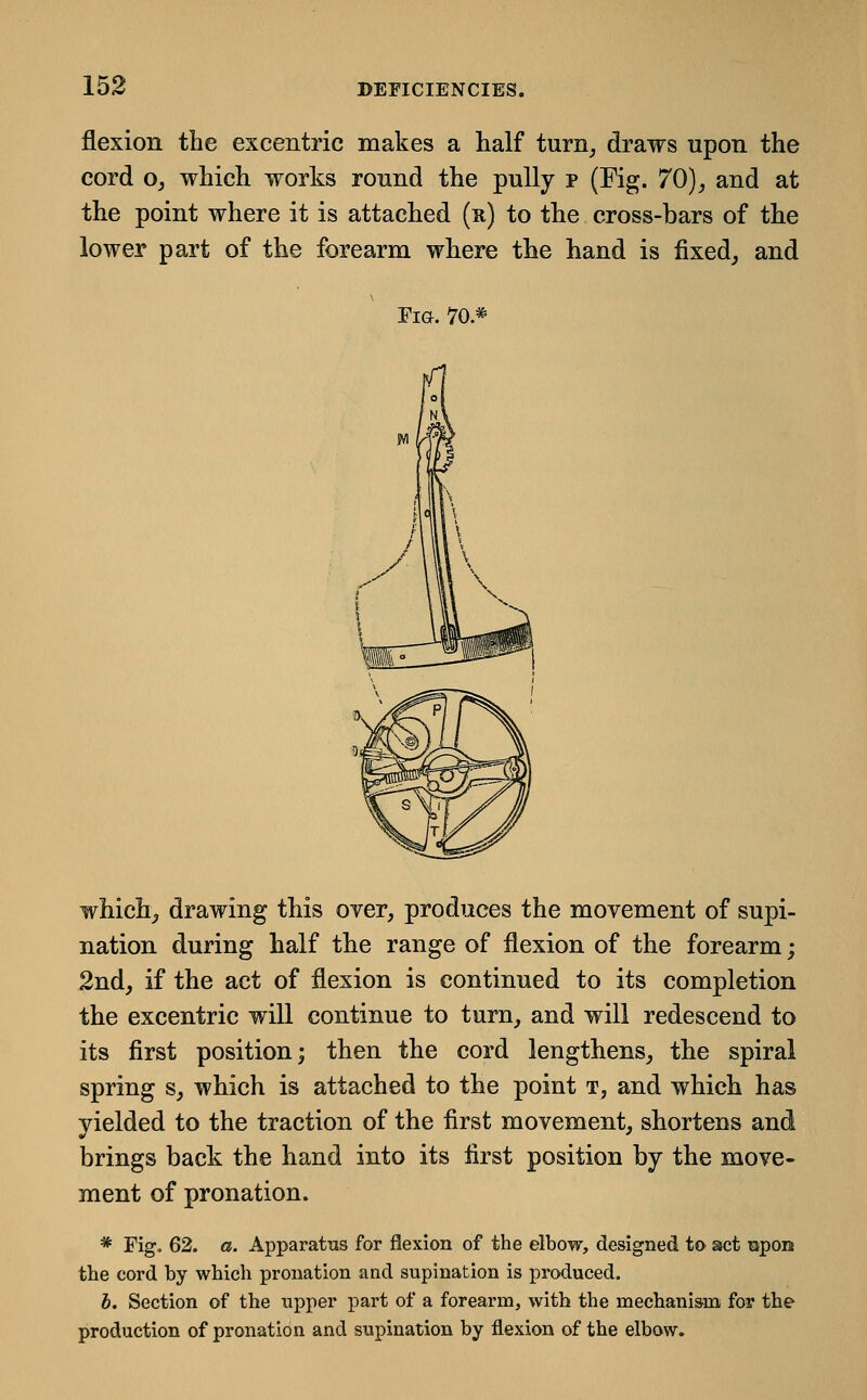 flexion the excentrie makes a half turn^ draws upon the cord o, which works round the puUy p (Fig. 70)^ and at the point where it is attached (n) to the cross-bars of the lower part of the forearm where the hand is fixed^ and Fig. 70 * which_, drawing this over, produces the movement of supi- nation during half the range of flexion of the forearm; 2nd_, if the act of flexion is continued to its completion the excentrie will continue to turn, and will redescend to its first position; then the cord lengthens,, the spiral spring s, which is attached to the point t, and which has yielded to the traction of the first movement, shortens and brings back the hand into its first position by the move- ment of pronation. * Fig, 62. a. Apparatus for flexion of the elbow, designed to act upois the cord by which pronation and supination is produced, h. Section of the upper part of a forearm, with the mechanism for the production of pronation and supination by flexion of the elbow.