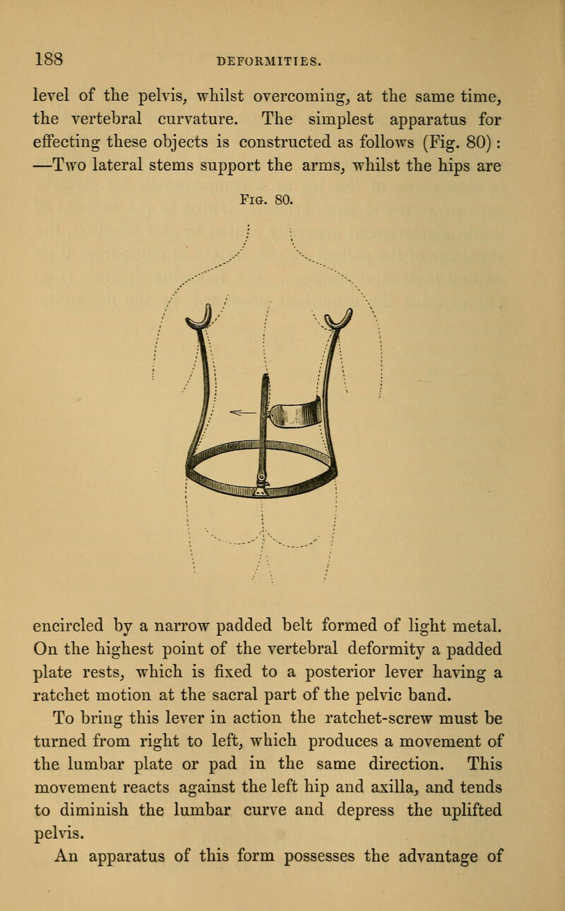 level of tlie pelvis, whilst overcoming, at the same time, the vertebral curvature. The simplest apparatus for effecting these objects is constructed as follows (Fig. 80): —Two lateral stems support the arms, whilst the hips are Fig. 80. encircled by a narrow padded belt formed of light metal. On the highest point of the vertebral deformity a padded plate rests, which is fixed to a posterior lever having a ratchet motion at the sacral part of the pelvic band. To bring this lever in action the ratchet-screw must be turned from right to left, which produces a movement of the lumbar plate or pad in the same direction. This movement reacts against the left hip and axilla, and tends to diminish the lumbar curve and depress the uplifted pelvis. An apparatus of this form possesses the advantage of