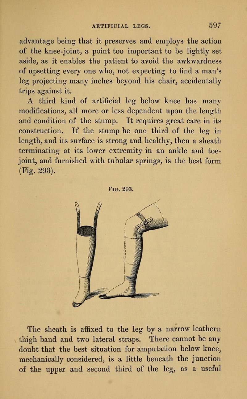 advantage being tliat it preserves and employs the action of the knee-joint, a point too important to be lightly set aside, as it enables the patient to avoid the awkwardness of upsetting every one who, not expecting to find a man-'s leg projecting many inches beyond his chair, accidentally trips against it. A third kind of artificial leg below kaee has many modifications, all more or less dependent upon the length and condition of the stump. It requires great care in its construction. If the stump be one third of the leg in length, and its surface is strong and healthy, then a sheath terminating at its lower extremity in an ankle and toe- joint, and furnished with tubular springs, is the best form '(Fig. 293). Fi&. 293. The sheath is affixed to the leg by a narrow leathern thigh band and two lateral straps. There cannot be any doubt that the best situation for amputation below knee, mechanically considered, is a little beneath the junction of the upper and second third of the leg, as a useful