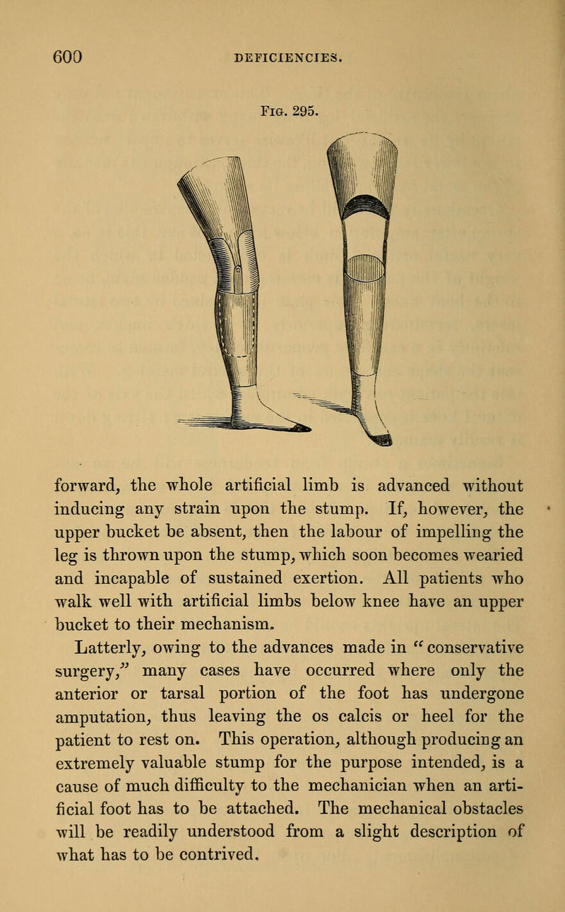 Fm. 295. forward, the whole artificial limb is advanced without inducing any strain upon the stump. If, however, the upper bucket be absent, then the labour of impelling the leg is thrown upon the stump, which soon becomes wearied and incapable of sustained exertion. All patients who walk well with artificial limbs below knee have an upper bucket to their mechanism. Latterly, owing to the advances made in  conservative surgery,^^ many cases have occurred where only the anterior or tarsal portion of the foot has undergone amputation, thus leaving the os calcis or heel for the patient to rest on. This operation, although producing an extremely valuable stump for the purpose intended, is a cause of much difficulty to the mechanician when an arti- ficial foot has to be attached. The mechanical obstacles will be readily understood from a slight description of what has to be contrived.