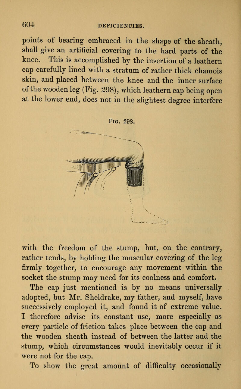 points of bearing embraced in tbe shape of the sheath, shall give an artificial covering to the hard parts of the knee. This is accomplished by the insertion of a leathern cap carefully lined with a stratum of rather thick chamois skin, and placed between the knee and the inner surface of the wooden leg (Fig. 298), which leathern cap being open at the lower end, does not in the slightest degree interfere Fig. 298. with the freedom of the stump, but, on the contrary, rather tends, by holding the muscular covering of the leg firmly together, to encourage any movement within the socket the stump may need for its coolness and comfort. The cap just mentioned is by no means universally adopted, but Mr. Sheldrake, my father, and myself, have successively employed it, and found it of extreme value. I therefore advise its constant use, more especially as every particle of friction takes place between the cap and the wooden sheath instead of between the latter and the stump, which circumstances would inevitably occur if it were not for the cap. To show the great amount of difficulty occasionally