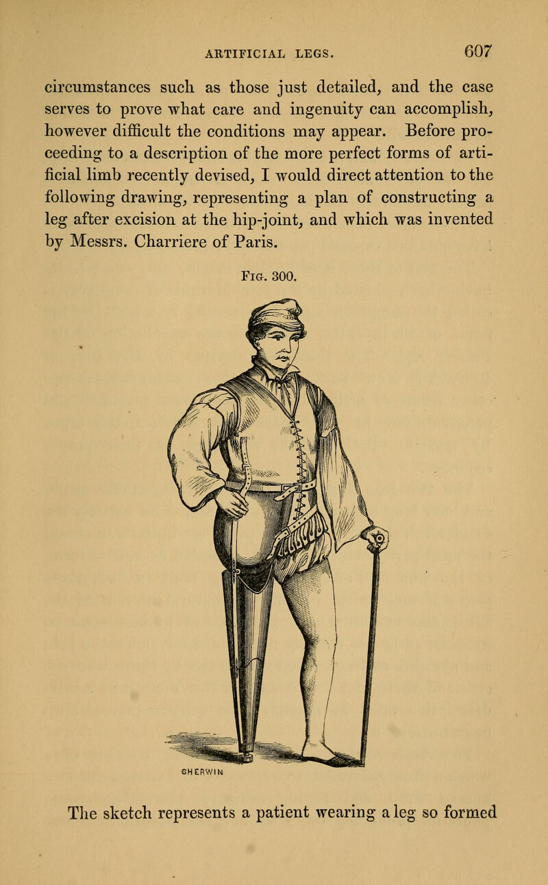 circumstances such as those just detailed, aud the case serves to prove what care and ingenuity can accomplish, however difficult the conditions may appear. Before pro- ceeding to a description of the more perfect forms of arti- ficial limb recently devised, I would direct attention to the following drawing, representing a plan of constructing a leg after excision at the hip-joint, and which was invented by Messrs. Charriere of Paris. Fig. 300. The sketch represents a patient wearing a leg so formed