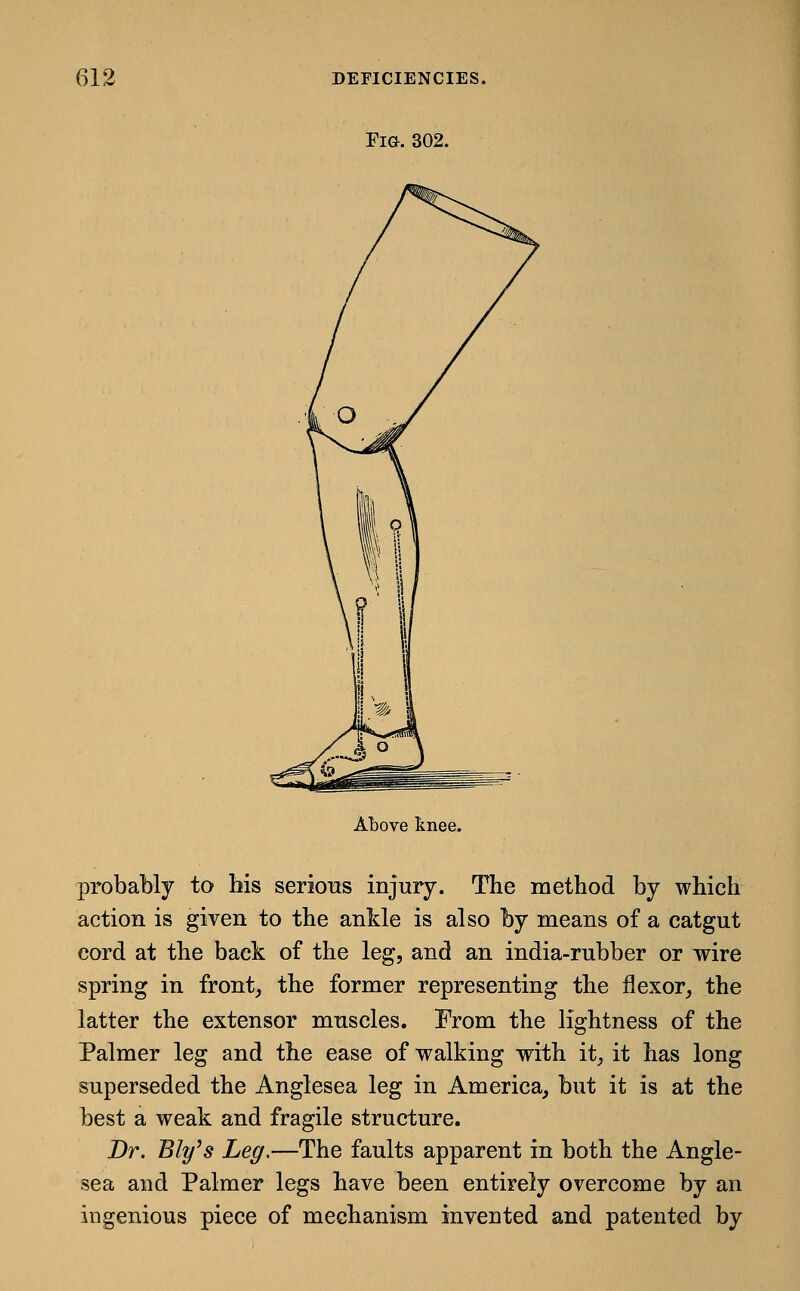 Fig. 302. Above knee. probably to bis serious injury. The method by which action is given to the ankle is also by means of a catgut cord at the back of the leg, and an india-rubber or wire spring in front, the former representing the flexor, the latter the extensor muscles. From the lightness of the Palmer leg and the ease of walking with it, it has long superseded the Anglesea leg in America, but it is at the best a weak and fragile structure. Br. Ely's Leg,—The faults apparent in both the Angle- sea and Palmer legs have been entirely overcome by an ingenious piece of mechanism invented and patented by