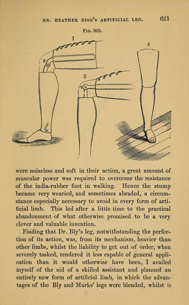 Fig. 305. were noiseless and soft in their action, a great amount of muscular power was required to overcome the resistance of the india-rubber foot in walking. Hence the stump became very wearied, and sometimes abraded, a circum- stance especially necessary to avoid in every form of arti- ficial limb. This led after a little time to the practical abandonment of what otherwise promised to be a very clever and valuable invention. Finding that Dr. Bly^s leg, notwithstanding the perfec- tion of its action, was, from its mechanism, heavier than other limbs, whilst the liability to get out of order, when severely tasked, rendered it less capable of general appli- cation than it would otherwise have been, I availed myself of the aid of a skilled assistant and planned an entirely new form of artificial limb, in which the advan- tages of the Bly and Marks' legs were blended, whilst it