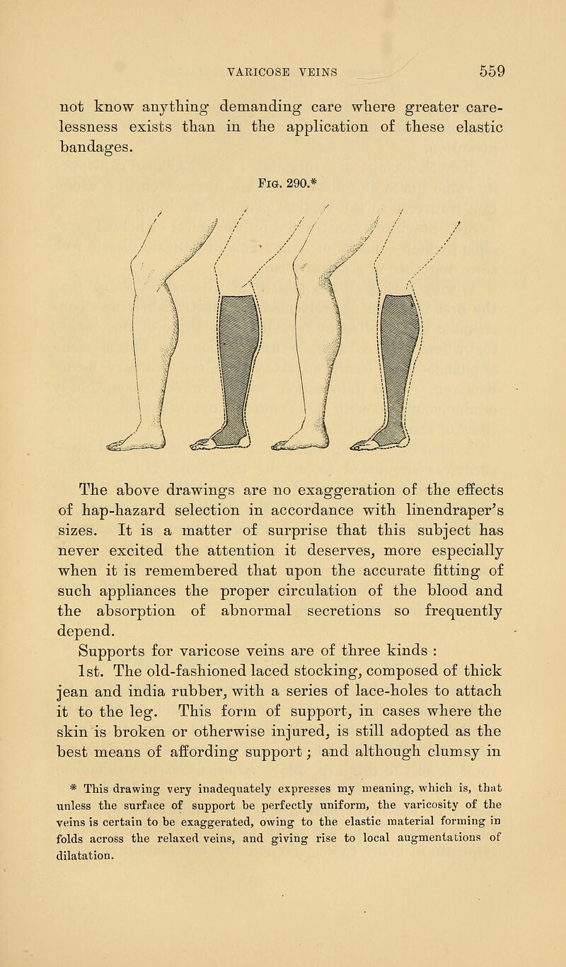 not know anything demanding care where greater care- lessness exists than in the application of these elastic bandages. Fig. 290 * The above drawings are no exaggeration of the effects of hap-hazard selection in accordance with linendraper's sizes. It is a matter of surprise that this subject has never excited the attention it deserves, more especially when it is remembered that upon the accurate fitting of such appliances the proper circulation of the blood and the absorption of abnormal secretions so frequently depend. Supports for varicose veins are of three kinds : 1st. The old-fashioned laced stocking, composed of thick jean and india rubber, with a series of lace-holes to attach it to the leg. This form of support, in cases where the skin is broken or otherwise injured, is still adopted as the best means of affording support; and although clumsy in * This drawing very inadequately expresses my meaning, which is, that unless the surface of support be perfectly uniform, the varicosity of the veins is certain to be exaggerated, owing to the elastic material forming in folds across the relaxed veins, and giving rise to local augmentations of dilatation.