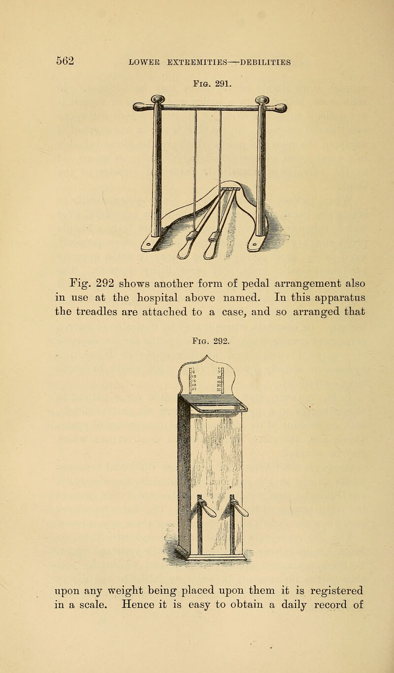 Fig. 291. Fig. 292 shows another form of pedal arrangement also in use at the hospital above named. In this apparatus the treadles are attached to a case, and so arranged that Fig. 292. upon any weight being placed upon them it is registered in a scale. Hence it is easy to obtain a daily record of