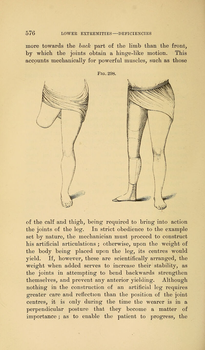 more towards the back part of the limb than the front, by which the joints obtain a hinge-like motion. This accounts mechanically for powerful muscles, such as those Fig.298. of the calf and thigh, being required to bring into action the joints of the leg. In strict obedience to the example set by nature, the mechanician must proceed to construct his artificial articulations ; otherwise, upon the weight of the body being placed upon the leg, its centres would yield. If, however, these are scientifically arranged, the weight when added serves to increase their stability, as the joints in attempting to bend backwards strengthen themselves, and prevent any anterior yielding. Although nothing in the construction of an artificial leg requires greater care and reflection than the position of the joint centres, it is only during the time the wearer is in a perpendicular posture that they become a matter of importance; as to enable the patient to progress, the