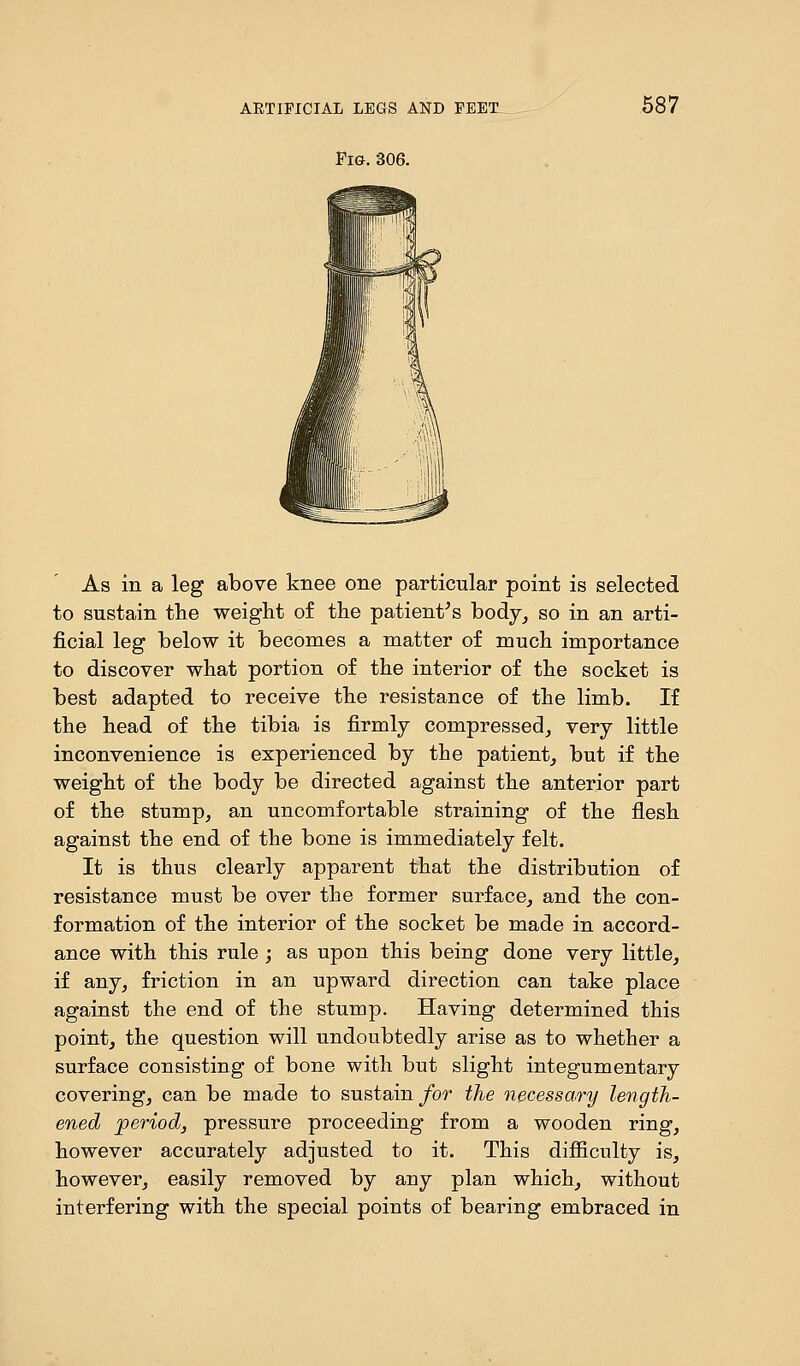 Fig. 306. 587 As in a leg above knee one particular point is selected to sustain the weight of the patient's body, so in an arti- ficial leg below it becomes a matter of much importance to discover what portion of the interior of the socket is best adapted to receive the resistance of the limb. If the head of the tibia is firmly compressed, very little inconvenience is experienced by the patient, but if the weight of the body be directed against the anterior part of the stump, an uncomfortable straining of the flesh against the end of the bone is immediately felt. It is thus clearly apparent that the distribution of resistance must be over the former surface, and the con- formation of the interior of the socket be made in accord- ance with this rule ; as upon this being done very little, if any, friction in an upward direction can take place against the end of the stump. Having determined this point, the question will undoubtedly arise as to whether a surface consisting of bone with but slight integumentary covering, can be made to sustain for the necessary length- ened period, pressure proceeding from a wooden ring, however accurately adjusted to it. This difficulty is, however, easily removed by any plan which, without interfering with the special points of bearing embraced in