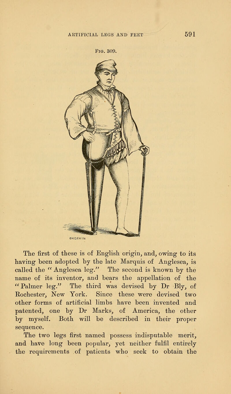 Fig. 309. The first of these is of English origin, and, owing to its having been adopted by the late Marquis of Anglesea, is called the  Anglesea leg. The second is known by the name of its inventor, and bears the appellation of the  Palmer leg. The third was devised by Dr Bly, of Rochester, New York. Since these were devised two other forms of artificial limbs have been invented and patented, one by Dr Marks, of America, the other by myself. Both will be described in their proper sequence. The two legs first named possess indisputable merit, and have long been popular, yet neither fulfil entirely the requirements of patients who seek to obtain the