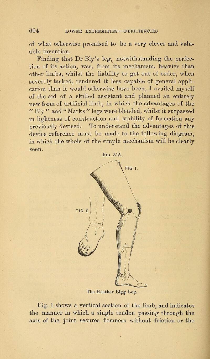 of what otherwise promised to be a very clever and valu- able invention. Finding that Dr Bly's leg, notwithstanding the perfec- tion of its action, was, from its mechanism, heavier than other limbs, whilst the liability to get out of order, when severely tasked, rendered it less capable of general appli- cation than it would otherwise have been, I availed myself of the aid of a skilled assistant and planned an entirely new form of artificial limb, in which the advantages of the  Bly  and Marks  legs were blended, whilst it surpassed in lightness of construction and stability of formation any previously devised. To understand the advantages of this device reference must be made to the following diagram, in which the whole of the simple mechanism will be clearly seen. Fig.315. FIG. I. FIG The Heather Bigg Leg. Fig. 1 shows a vertical section of the limb, and indicates the manner in which a single tendon passing through the axis of the joint secures firmness without friction or the