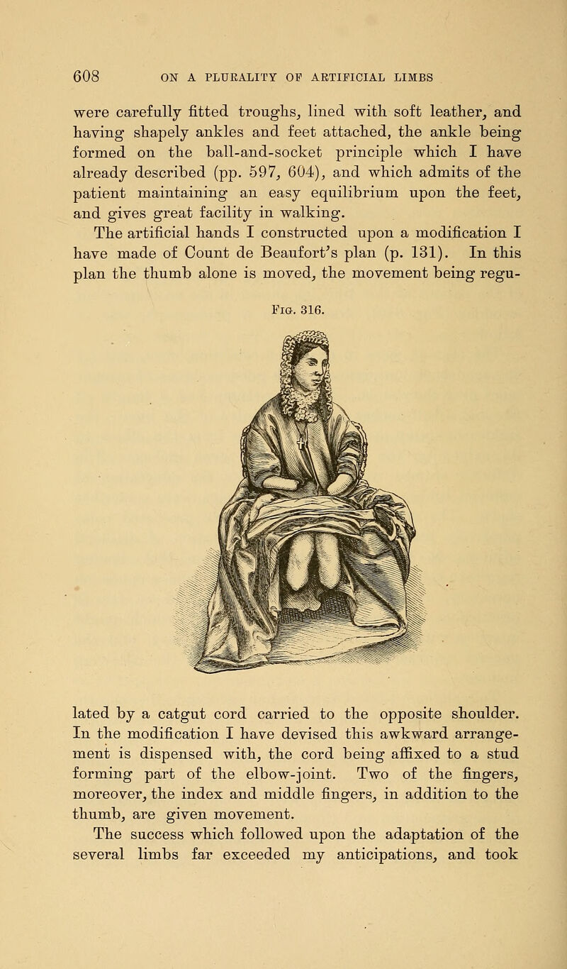 were carefully fitted troughs, lined with soft leather, and having shapely ankles and feet attached, the ankle being formed on the ball-and-socket principle which I have already described (pp. 597, 604), and which admits of the patient maintaining an easy equilibrium upon the feet, and gives great facility in walking. The artificial hands I constructed upon a modification I have made of Count de Beaufort's plan (p. 131). In this plan the thumb alone is moved, the movement being regu- Fig. 316. lated by a catgut cord carried to the opposite shoulder. In the modification I have devised this awkward arrange- ment is dispensed with, the cord being affixed to a stud forming part of the elbow-joint. Two of the fingers, moreover, the index and middle fingers, in addition to the thumb, are given movement. The success which followed upon the adaptation of the several limbs far exceeded my anticipations, and took