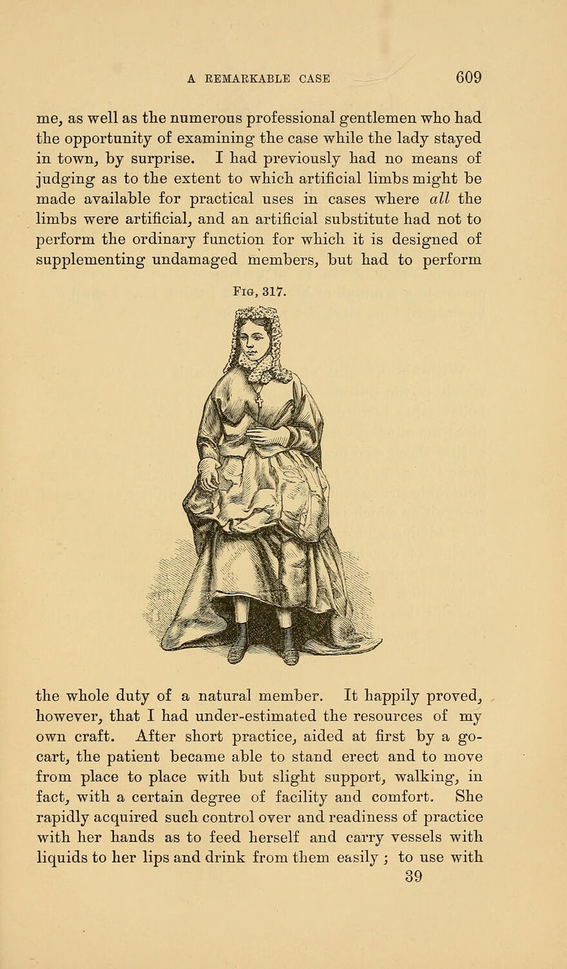 me, as well as the numerous professional gentlemen who had the opportunity of examining- the case while the lady stayed in town, by surprise. I had previously had no means of judging as to the extent to which artificial limbs might be made available for practical uses in cases where all the limbs were artificial, and an artificial substitute had not to perform the ordinary function for which it is designed of supplementing undamaged members, but had to perform Fig, 317. the whole duty of a natural member. It happily proved, however, that I had under-estimated the resources of my own craft. After short practice, aided at first by a go- cart, the patient became able to stand erect and to move from place to place with but slight support, walking, in fact, with a certain degree of facility and comfort. She rapidly acquired such control over and readiness of practice with her hands as to feed herself and carry vessels with liquids to her lips and drink from them easily ; to use with 39