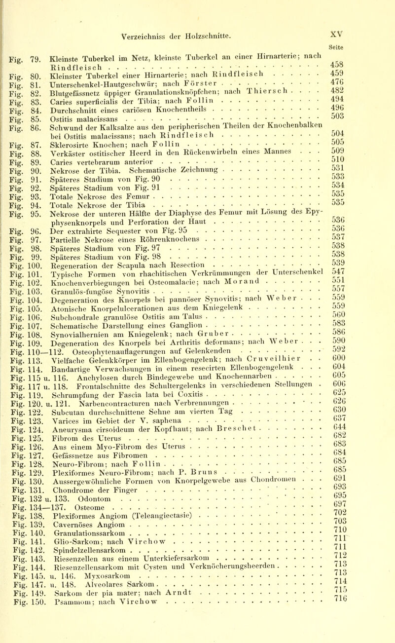 Seite Fig. 79. Kleinste Tuberkel im Netz, kleinste Tuberkel an einer Hirnarterie; nach Rindfleisch '  ', fro Fig. 80. Kleinster Tuberkel einer Hirnarteric; nach Rindfleisch 4.J9 Fig. 81. Unterschenkel-Hautgeschwür; nach Förster 476 Fig. 82. Blutgefässnetz üppiger Granulationsknöpfchen; nach Thierse h . . . . 482 Fig. 83. Caries superücialis der Tibia; nach Follin 494 Fig. 84. Durchschnitt eines cariösen Knochentheils 4% Fig. 85. Ostitis malacissans ü n Fig. 86. Schwund der Kalksalze aus den peripherischen Theilen der Knochenbalken bei Ostitis malacissans; nach Rindfleisch 504 Fig. 87. Sklerosirte Knochen; nach Follin 505 Fig. 88. Verkäster ostitischer Heerd in den Rückenwirbeln eines Mannes ... JÜ9 Fig. 89. Caries vertebrarum anterior ^1^ Fig. 90. Nekrose der Tibia. Schematische Zeichnung J-jI Fig. 91. Späteres Stadium von Fig. 90 -^^o Fig. 92. Späteres Stadium von Fig. 91 •^•^f Fig. 93. Totale Nekrose des Femur ',^^^ Fig. 94. Totale Nekrose der Tibia . . . . • ^ • ^«^^ Fig. 95. Nekrose der unteren Hälfte der Diaphyse des Femur mit Lösung des Epy- ^ physenknorpels und Perforation der Haut ^36 Fig. 96. Der extrahirte Sequester von Fig. 95 5üG Fig. 97. Partielle Nekrose eines Röhrenknochens ^^7 Fig. 98. Späteres Stadium von Fig. 97 538 Fig. 99. Späteres Stadium von Fig. 98 ^^o Fig. 100. Regeneration der Scapula nach Reseetion 5^9 Fig. 101. Typische Formen von rhachitischen Verkrümmungen der Unterschenkel j47 Fig. 102. Knochenverbiegungen bei Osteomalacie; nach Mo r and 551 Fig. 103. Granulös-fungöse Synovitis 557 Fig. 104. Degeneration des Knoi-pels bei pannöser Synovitis; nach Weber • . • oo9 Fig. 105. Atonische Knorpelulcerationen aus dem Kniegelenk 5o9 Fig. 106. Subchondrale granulöse Ostitis am Talus -^)bO Fig. 107. Schematische Darstellung eines Ganglion J8o Fig. 108. Synovialhernien am Kniegelenk; nach Grub er ^86 Fig. 109, Degeneration des Knorpels bei Arthritis deformans; nach Weber . . . o9ü Fig. 110—112. Osteophytenauflagerungen auf Gelenkenden 592 Fig. 113. Vielfache Gelenkkörper im Ellenbogengelenk; nach Cr UV eil hier . . 600 Fig. 114. Bandartige Verwachsungen in einem resecirten Ellenbogengelenk ... 604 Fig. 115 u. 116. Anchylosen durch Bindegewebe und Knochennarben 605 Fig. 117 u. 118. Frontalschnitte des Schultergelenks in verschiedenen Stellungen . 606 Fig. 119. Schrumpfung der Fascia lata bei Coxitis 625 Fig. 120. u. 121. Narbencontracturen nach Verbrennungen • • • 626 Fig. 122. Subcutan durchschnittene Sehne am vierten Tag 630 Fig. 123. Varices im Gebiet der V. saphena 6o7 Fig. 124. Aneurysma cirsoideum der Kopfhaut; nach Bresehet 644 Fig. 125. Fibrom des Uterus ^°^ Fig. 126. Aus einem Myo-Fibrom des Uterus 683 Fig. 127. Gefässnetze aus Fibromen 6^f Fig. 128. Neuro-Fibrom; nach Follin 68o Fig. 129. Plexiformes Neuro-Fibrom; nach P. Bruns 68o Fig. 130. Aussergewöhnliche Formen von Knorpelgewebe aus Chondromen ... 091 Fig. 131. Chondrome der Finder ' ' 693 Fig. 132 u. 133. Odontom •.-.... b^b Fig. 134—137. Osteome ' ^^! Fig. 138. Plexiformes Angiom (Teleangiectasie)  ^^^ Fig. 139. Cavernöses Angiom ' J^ Fig. 140. Granulationssarkom ^fj^ Fig. 141. Glio-Sarkom; nach Virchow j.|| Fig. 142. Spindelzellensarkom ^ A^ Fig. 143. Riesenzellen aus einem Unterkiefersarkom ''■^ Fig. 144. Riesenzellensarkom mit Cysten und Verknöcherungsheerden 71o Fig. 145. u. 146. Myxosarkom ^|^ Fig. 147. u. 148. Alveolares Sarkom J.'^J Fig. 149. Sarkom der pia niater; nach Arndt '||^ Fig. 150. Psammom; nach Virchow - '^6