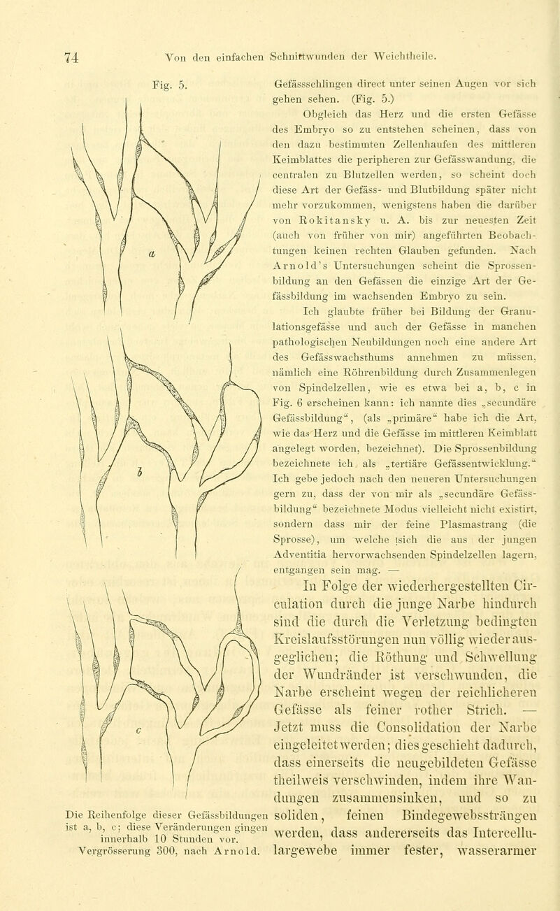 Fig. 5. Gefässschlingen direct unter seinen Augen vor sich gehen sehen. (Fig. .5.) Obgleich das Herz und die ersten Gefässe des Embryo so zu entstehen scheinen, dass von den dazu bestimmten Zellenhaufen des mittleren Keimblattes die peripheren zur Gefässwandung, die centralen zu Blutzellen werden, so scheint doch diese Art der Gefäss- und Blutbildung später nicht mehr vorzukommen, wenigstens haben die darüber von Rokitansky vi. A. bis zur neuesten Zeit (auch von früher von mir) angeführten Beobach- tungen keinen rechten Glauben gefunden. Nach Arnold's Untersuchungen scheint die Sprossen- bildung an den Gefässen die einzige Art der Ge- fässbildung im wachsenden Embryo zu sein. Ich glaubte früher bei Bildung der Granu- lationsgefässe und auch der Gefässe in manchen pathologischen Neubildungen noch eine andei-e Ai-t des Gefässwachsthums annehmen zu müssen, nämlich eine Röhrenbildung durch Zusammenlegen von Spindelzellen, wie es etwa bei a, b, c in Fig. 6 erscheinen kann: ich nannte dies ,.secundäre Gefässbildung'^, (als „primäre habe ich die Ai-t, wie das Herz und die Gefässe im mittleren Keimblatt angelegt worden, bezeichnet). Die Sprossenbildung bezeichnete ich als „tertiäre Gefässentwickluug. Ich gebe jedoch nach den neueren Untersuchungen gern zu, dass der von mir als „secundäre Gefäss- bildung bezeichnete Modus vielleicht nicht existirt, sondern dass mir der feine Plasmasti-ang (die Sprosse), um welche isich die aus der jungen Adventitia hervorwachsenden Spindelzellen lagern, entgangen sein mag. — In Folge der wiederhergestellten Cir- culation durch die junge Narbe hindurch sind die durch die Verletzung bedingten Kreislaufsstörungen nun völlig wieder aus- geglichen; die Röthung und Schwellung der Wundränder ist verschwunden, die Narbe erscheint wegen der reichlicheren Gefässe als feiner rother Strich. — Jetzt muss die Consolidation der Narbe eingeleitet werden; dies geschieht dadurch, dass einerseits die neugebildeten Gefässe theilweis verschwinden, indem iln-e Wan- dungen zusammensinken, und so zu feinen Bindegewebssträngen Die Reihenfolge dieser Gefässbildungen SOliden, ' '•'ir:US:lS'l:^::r'' ^^-'-^^i. -^««^ andererseits das Intei-cellu- Vergrösserung 300, nach Arnold, largewebe immer fester, wasserarmer