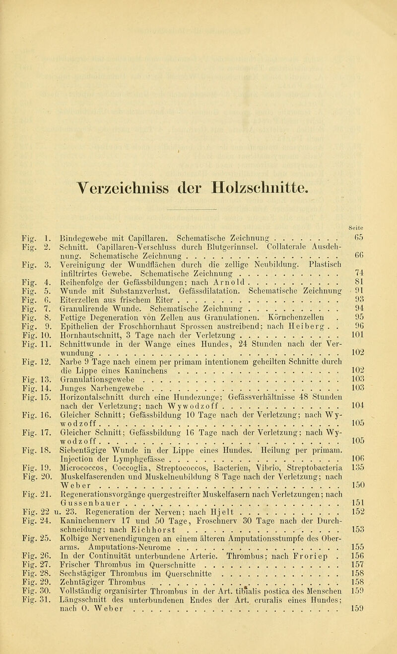 Verzeichniss der Holzschnitte. Seite Fig. 1. Bindegewebe mit Capillaren. Schematische Zeichnung 65 Fig. 2. Schnitt. Capillaren-Verschlnss durch Blutgerinnsel. Collaterale Ausdeh- nung. Schematische Zeichnung 66 Fig. 3. Vereinigung der Wundflächen durch die zellige Neubildung. Plastisch infiltrirtes Gewebe. Schematische Zeichnung 74 Fig. 4. Reihenfolge der Gefässbildüngen; nach Arnold 81 Fig. 5. Wunde mit Substanzverlust. Gefässdilatation. Schematische Zeichnung 91 Fig. 6. Eiterzellen aus frischem Eiter 93 Fig. 7. Granulirende Wunde, Schematische Zeichnung 94 Fig. 8. Fettige Degeneration von Zellen aus Granulationen. Körnchenzeilen . 95 Fig. 9. Epithelien der Froschhornhaut Sprossen austreibend; nach Heiberg . . 96 Fig. 10. Hornhautschnitt, 3 Tage nach der Verletzung 101 Fig. 11. Schnittwunde in der Wange eines Hundes, 24 Stunden nach der Ver- wundung 102 Fig. 12. Narbe 9 Tage nach einem per primam intentionem geheilten Schnitte durch die Lippe eines Kaninchens 102 Fig. 13. Granulationsgewebe 103 Fig. 14. Junges Narbengewebe 103 Fig. 15. Horizontalschnitt durch eine Hundezunge; Gefässverhältnisse 48 Stunden nach der Verletzung; nach Wywodzoff 104 Fig. 16. Gleicher Schnitt; Gefässbildung 10 Tage nach der Verletzung; nach Wy- wodzoff 105 Fig. 17. Gleicher Schnitt; Gefässbildung 16 Tage nach der Verletzung; nach Wy- wodzoff 105 Fig. 18. Siebentägige Wunde in der Lippe eines Hundes. Heilung per primam. Injection der Lymphgefässe 106 Fig. 19. Micrococcos, Coccoglia, Streptococcos, Bacterien, Vibrio, Streptobacteria 135 Fig. 20. Muskelfaserenden und Muskelneubildung 8 Tage nach der Verletzung; nach Weber 150 Fig. 21. RegenerationsYorgänge quergestreifter Muskelfasern nach Verletzungen; nach Gussenbauer , 151 Fig. 22 u. 23. Regeneration der Nerven; nach Hjelt 152 Fig. 24. Kaninchennerv 17 und 50 Tage, Froschnerv 30 Tage nach der Durch- schneidung; nach Eichhorst 153 Fig. 25. Kolbige Nervenendigungen an einem älteren Amputationsstumpfe des Ober- arms. Amputations-Neurome 155 Fig. 26. In der Continuität unterbundene Arterie. Thrombus; nach Froriep . 156 Fig. 27. Frischer Thrombus im Querschnitte 157 Fig. 28. Sechstägiger Thrombus im Querschnitte 158 Fig. 29. Zehntägiger Thrombus . 158 Fig. 30. Vollständig organisirter Thrombus in der Art. tiblalis postica des Menschen 159 Fig. 31. Längsschnitt des unterbundenen Endes der Art. cruralis eines Hundes; nach 0. Weber 159