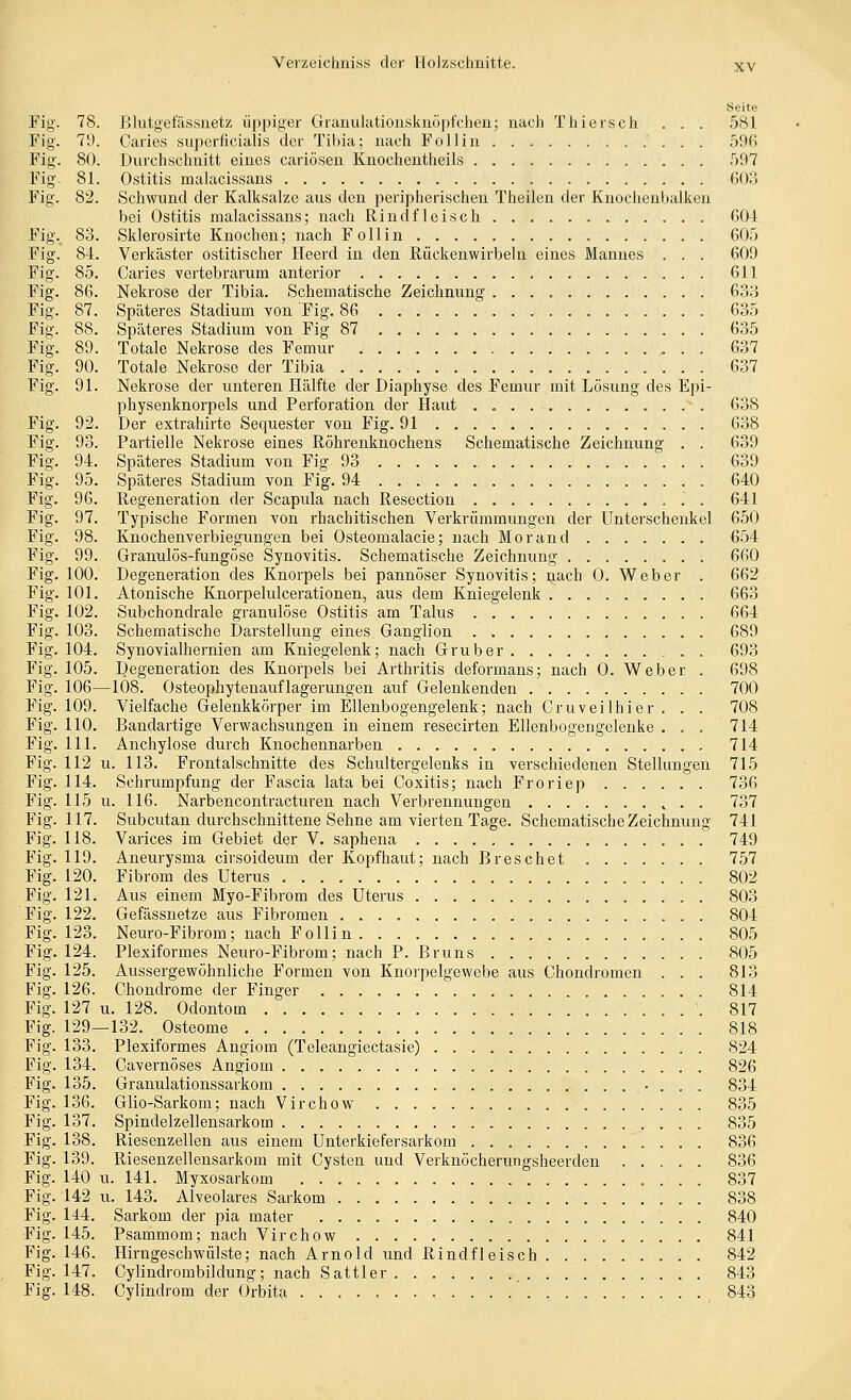 Seite Fig. 78. Blutgefässnetz üppiger Granulationsknöpfclien; nach Thiersch . . . 581 Fig. 79. Garies superficialis der Tibia; nach Fol 1 in 596 Fig. 80. Durchschnitt eines cariösen Knochentheils 597 Fig. 81. Ostitis malacissans fiOo Fig. 82. Schwund der Kalksalzc aus den peripherischen Theilen der Knochenbalken bei Ostitis malacissans; nach Rindfleisch 604 Fig. 83. Sklerosirte Knochen; nach Follin 605 Fig. 84. Verkäster ostitischer Ileerd in den Rückenwirbeln eines Mannes . . . 609 Fig. 85. Caries vertebrarum anterior 611 Fig. 86. Nekrose der Tibia. Schematische Zeichnung 633 Fig. 87. Späteres Stadium von Fig. 86 635 Fig. 88. Späteres Stadium von Fig 87 635 Fig. 89. Totale Nekrose des Femur 637 Fig. 90. Totale Nekrose der Tibia 637 Fig. 91. Nekrose der unteren Hälfte der Diaphyse des Femur mit Lösung des Epi- physenknorpels und Perforation der Haut . 638 Fig. 92. Der extrahirte Sequester von Fig. 91 638 Fig. 93. Partielle Nekrose eines Röhrenknochens Schematische Zeichnung . . 639 Fig. 94. Späteres Stadium von Fig 93 639 Fig. 95. Späteres Stadium von Fig. 94 640 Fig. 96. Regeneration der Scapula nach Resection 641 Fig. 97. Typische Formen von rhachitischen Verkrümmungen der Unterschenkel 650 Fig. 98. Knochenverbiegungen bei Osteomalacie; nach Morand 654 Fig. 99. Granulös-fungöse Synovitis. Schematische Zeichnung 660 Fig. 100. Degeneration des Knorpels bei pannöser Synovitis; nach 0. Weber . 662 Fig. 101. Atonische Knorpelulcerationen, aus dem Kniegelenk 663 Fig. 102. Subchondrale granulöse Ostitis am Talus 664 Fig. 103. Schematische Darstellung eines Ganglion 689 Fig. 104. Synovialhernien am Kniegelenk; nach Grub er 693 Fig. 105. Degeneration des Knorpels bei Arthritis deformans; nach 0. Weber . 698 Fig. 106—108. Osteophytenauflagerungen auf Gelenkenden 700 Fig. 109. Vielfache Gelenkkörper im Ellenbogengelenk; nach Cruveilhier. . . 708 Fig. HO. Bandartige Verwachsungen in einem resecirten Ellenbogengelenke ... 714 Fig. 111. Anchylose durch Knochennarben 714 Fig. 112 u. 113. Frontalschnitte des Schultergelenks in verschiedenen Stellungen 715 Fig. 114. Schrumpfung der Fascia lata bei Coxitis; nach Froriep 736 Fig. 115 u. 116. Narbencontracturen nach Verbrennungen 737 Fig. 117. Subcutan durchschnittene Sehne am vierten Tage. Schematische Zeichnung 741 Fig. 118. Varices im Gebiet der V. saphena 749 Fig. 119. Aneurysma cirsoideixm der Kopfhaut; nach Breschet 757 Fig. 120. Fibrom des Uterus 802 Fig. 121. Aus einem Myo-Fibrom des Uterus 803 Fig. 122. Gefässnetze aus Fibromen 804 Fig. 123. Neuro-Fibrom; nach Follin 805 Fig. 124. Plexiformes Neuro-Fibrom; nach P. ßruns 805 Fig. 125. Aussergewöhnliche Formen von Knorpelgewebe aus Chondromen . . . 813 Fig. 126. Chondrome der Finger 814 Fig. 127 u. 128. Odontom \ 817 Fig. 129—132. Osteome 818 Fig. 133. Plexiformes Augiom (Teleangiectasie) 824 Fig. 134. Cavernöses Angiom 826 Fig. 135. Granulationssarkom • . . . 834 Fig. 136. Glio-Sarkom; nach Virchow 835 Fig. 137. Spindelzellensarkom 835 Fig. 138. Riesenzellen aus einem Unterkiefersarkom 836 Fig. 139. Riesenzellensarkom mit Cysten und Verknöcherungsheerden ..... 836 Fig. 140 u. 141. Myxosarkom 837 Fig. 142 u. 143. Alveolares Sarkom 838 Fig. 144. Sarkom der pia mater 840 Fig. 145. Psammom; nach Virchow 841 Fig. 146. Hirngeschwülste; nach Arnold und Rindfleisch 842 Fig. 147. Cylindrombildung; nach Sattler 843 Fig. 148. Cylindrom der Orbita 843