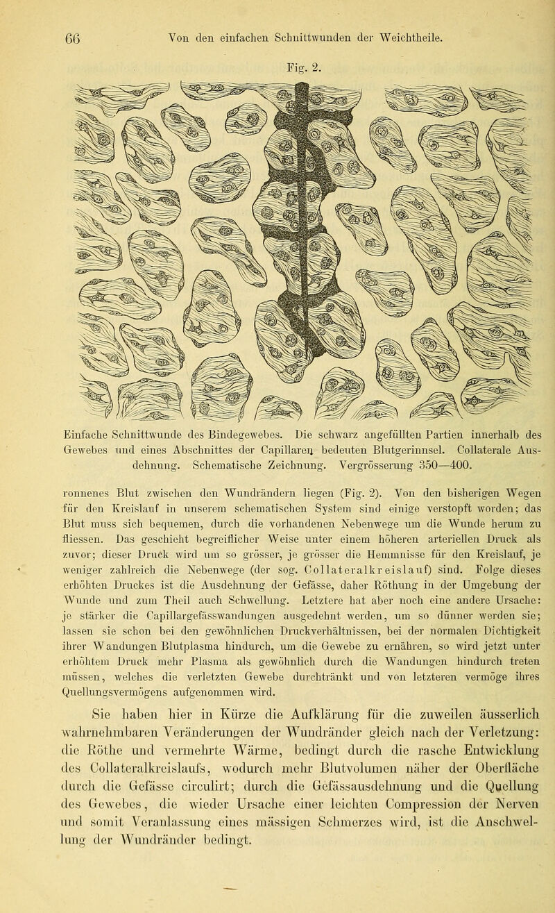 Fiff. 2. Einfache Schnittwunde des Bindegewebes. Die schwarz angefüllten Partien innerhalb des Gewebes und eines Abschnittes der Capillareii bedeuten Blutgerinnsel. Collaterale Aus- dehnung. Schematische Zeichnung. Vergrösserung 350—400. ronnenes Blut zwischen den Wundrändern liegen (Fig. 2). Von den bisherigen Wegen für den Kreislauf in unserem schematischen System sind einige verstopft worden; das Blut muss sich bequemen, durch die vorhandenen Nebenwege um die Wunde herum zu fliessen. Das geschieht begreiflicher Weise unter einem höheren arteriellen Druck als zuvor; dieser Druck wird um so grösser, je grösser die Hemmnisse für den Kreislauf, je weniger zahlreich die Nebenwege (der sog. Collateralkreislauf) sind. Folge dieses erhöhten Druckes ist die Ausdehnung der Gefässe, daher Röthung in der Umgebung der Wunde und zum Theil auch Schwellung. Letztere hat aber noch eine andere Ursache: je stärker die Capillargefässwandungen ausgedehnt werden, um so dünner werden sie; lassen sie schon bei den gewöhnlichen Druckverhältnissen, bei der normalen Dichtigkeit ihrer Wandungen Blutplasma hindurch, um die Gewebe zu ernähren, so wird jetzt unter erhöhtem Druck mehr Plasma als gewöhnlich durch die Wandungen hindurch treten müssen, welches die verletzten Gewebe durchtränkt und von letzteren vermöge ihres Quellungsvermögens aufgenommen wird. Sie haben hier in Kürze die Aufklärnng für die zuweilen äusserlich wahrnehmbaren Veränderungen der Wundränder gieicli nach der Verletzung: die Röthe und vermehrte Wärme, bedingt durch die rasche Entwicklung des Collateralkreislaufs, wodurch mehr Blutvolumen näher der Oberfläche durch die Gefässe circulirt; durch die Gefässausdehnung und die Qyellung des Gewebes, die wieder Ursache einer leichten Compression der Nerven und somit Veranlassung eines massigen Schmerzes wird, ist die Anscliwel- luns; der Wundränder bedingt.