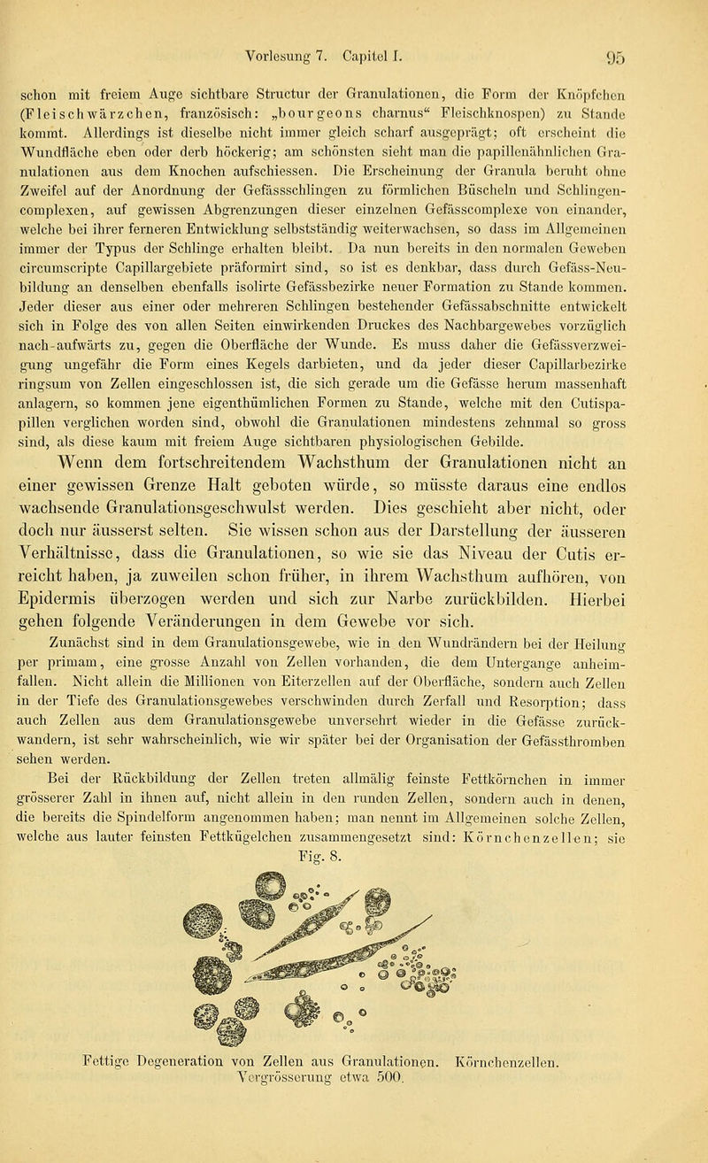 schon mit freiem Auge sichtbare Structur der Granulationen, die Form der Knöpfchen (Fleischwärzchen, französisch: „bourgeons charnus Fleischknospen) zu Stande kommt. Allerdings ist dieselbe nicht immer gleich scharf ausgeprägt; oft erscheint die Wiindfläche eben oder derb höckerig; am schönsten sieht man die papillenähnlichen Gra- nulationen aiis dem Knochen aufschiessen. Die Erscheinung der Granula beruht ohne Zweifel auf der Anordnung der Gefässschlingen zu förmlichen Büscheln und Schlingen- complexen, auf gewissen Abgrenzungen dieser einzelnen Gefässcomplexe von einander, welche bei ihrer ferneren Entwicklung selbstständig weiterwachsen, so dass im Allgemeinen immer der Typus der Schlinge erhalten bleibt. Da nun bereits in den normalen Geweben circumscripte Capillargebiete präformirt sind, so ist es denkbar, dass durch Gefäss-Neu- bildung an denselben ebenfalls isolirte Gefässbezirke neuer Formation zu Stande kommen. Jeder dieser aus einer oder mehreren Schlingen bestehender Gefässabschnitte entwickelt sich in Folge des von allen Seiten einwirkenden Druckes des Nachbargewebes vorzüglich nach-aufwärts zu, gegen die Oberfläche der Wunde. Es muss daher die Gefässverzwei- gung ungefähr die Form eines Kegels darbieten, und da jeder dieser Capillarbezirke ringsum von Zellen eingeschlossen ist, die sich gerade um die Gefässe herum massenhaft anlagern, so kommen jene eigenthümlichen Formen zu Stande, welche mit den Cutispa- pillen verglichen worden sind, obwohl die Granulationen mindestens zehnmal so gross sind, als diese kaum mit freiem Auge sichtbaren physiologischen Gebilde. Wenn dem fortschreitendem Wachsthum der Granulationen nicht an einer gewissen Grenze Halt geboten würde, so müsste daraus eine endlos wachsende Granulationsgeschwulst werden. Dies geschieht aber nicht, oder doch nur äusserst selten. Sie wissen schon aus der Darstellung der äusseren Verhältnisse, dass die Granulationen, so wie sie das Niveau der Cutis er- reicht haben, ja zuweilen schon früher, in ihrem Wachsthum aufhören, von Epidermis überzogen werden und sich zur Narbe zurückbilden. Hierbei gehen folgende Veränderungen in dem Gewebe vor sich. Zunächst sind in dem Granulationsgewebe, wie in den Wundrändern bei der Heiluno- per primam, eine grosse Anzahl von Zellen vorhanden, die dem Untergänge anheim- fallen. Nicht allein die Millionen von Eiterzellen auf der Oberfläche, sondern auch Zellen in der Tiefe des Granulationsgewebes verschwinden durch Zerfall und Resorption; dass auch Zellen aus dem Granulationsgewebe unversehrt wieder in die Gefässe zurück- wandern, ist sehr wahrscheinlich, wie wir später bei der Organisation der Gefässthromben sehen werden. Bei der Rückbildung der Zellen treten allmälig feinste Fettkörnchen in immer grösserer Zahl in ihnen auf, nicht allein in den runden Zellen, sondern auch in denen, die bereits die Spindelform angenommen haben; man nennt im Allgemeinen solche Zellen, welche aus lauter feinsten Fettkügelchen zusammengesetzt sind: Körnchenzell«n; sie Fig. 8. Fettige Degeneration von Zellen aus Granulationen. Yergrösserung etwa 500. Körncbenzellen.