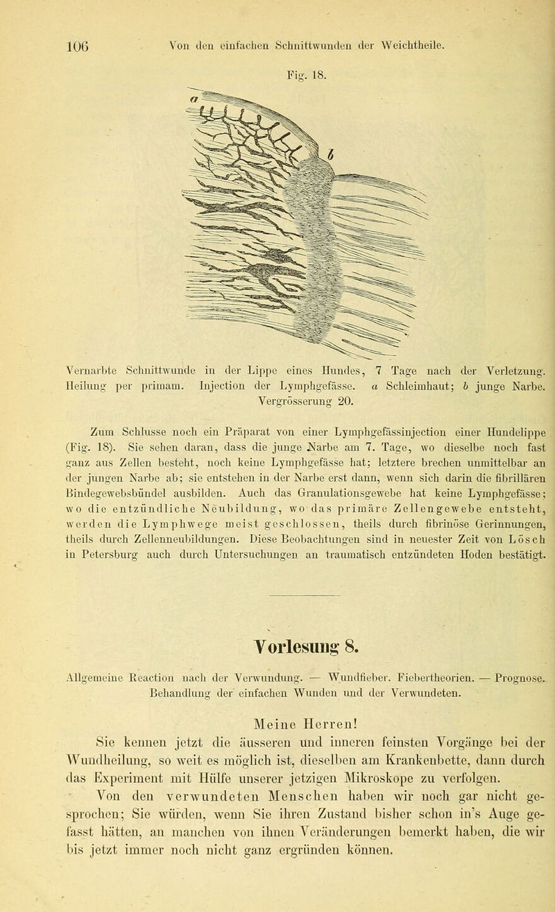 Fig. 18. Vernarbte Schnittwunde in der Lippe eines Hundes, 7 Tage nach der Verletzung. Heilung per primam. Injection der Lymphgefässe. a Schleimhaut; b junge Narbe. Vergrösserung 20. Zum Schlüsse noch ein Präparat von einer Lymphgefässinjection einer Hundelippe (Fig. 18). Sie sehen daran, dass die junge JSlarbe am 7. Tage, wo dieselbe noch fast ganz aus Zellen besteht, noch keine Lymphgefässe hat; letztere brechen unmittelbar an der jungen Narbe ab; sie entstehen in der Narbe erst dann, wenn sich darin die fibrillären Bindegewebsbündel ausbilden. Auch das Granulationsgewebe hat keine Lymphgefässe; wo die entzündliche Neubildung, wo das primäre Zellengewebe entsteht, werden die Lymphwege meist geschlossen, theils durch fibrinöse Gerinnungen, theils durch Zellenneubildungen. Diese Beobachtungen sind in neuester Zeit von Lösch in Petersburg auch durch Untersuchungen au traumatisch entzündeten Hoden bestätigt. Vorlesung 8. Allgemeine Reaction nach der Verwundung. — Wundfieber. Fiebertheorien. — Prognose. Behandlung der einfachen Wunden und der Verwundeten. Meine Herren! Sie kennen jetzt die äusseren und inneren feinsten Vorgänge bei der Wundheilung, so weit es möglich ist, dieselben am Krankenbette, dann dm'ch das Experiment mit Hülfe unserer jetzigen Mikroskope zu verfolgen. Von den verwundeten Menschen haben wir noch gar nicht ge- sprochen; Sie würden, wenn Sie ihren Zustand bisher schon in's Auge ge- fasst hätten, an manchen von ihnen Veränderungen bemerkt haben, die wir bis jetzt immer noch nicht ganz ergründen können.